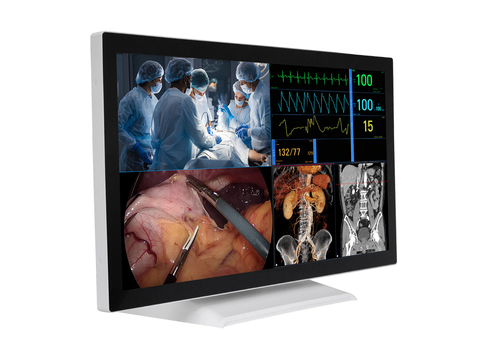 Barco AMM 215WTTP 21.5” Full HD Touchscreen Color Clinical Review Display Monitor - Image 3