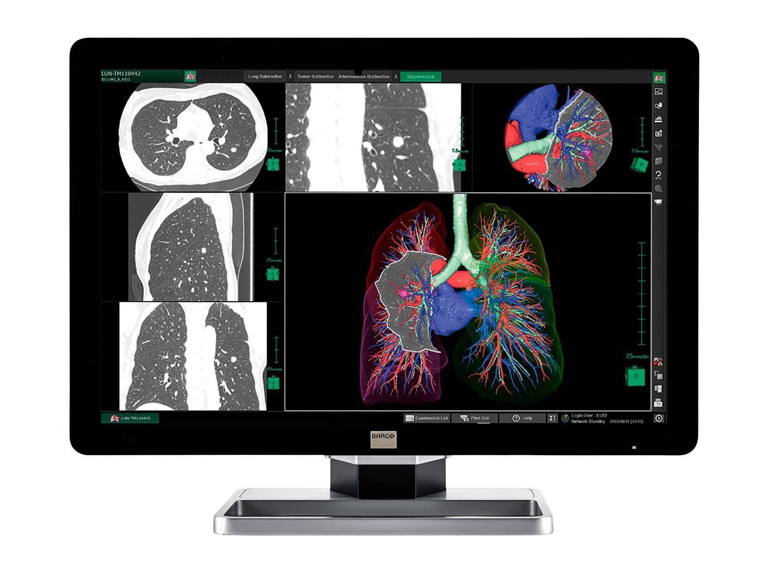 Barco Coronis Fusion MDCC-6130 6MP 30" PACS Display (includes MXRT-5550 GPU)