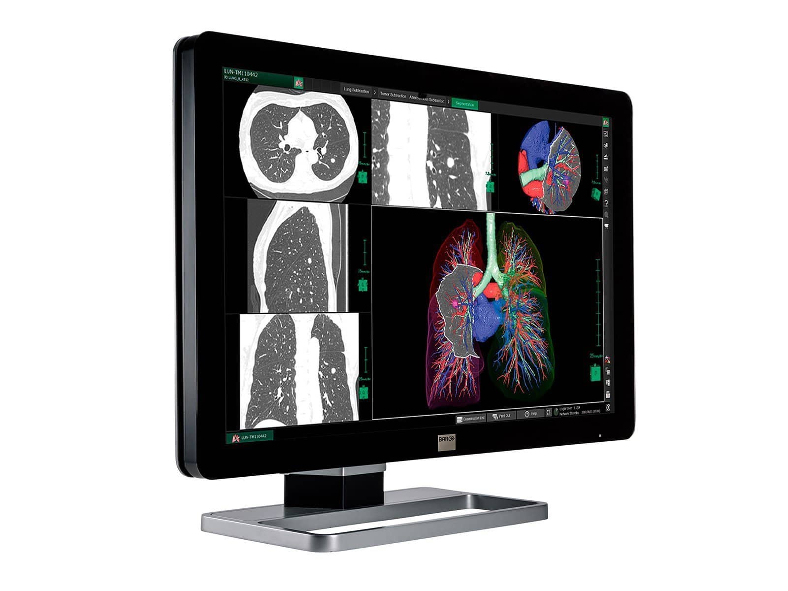 Barco Coronis Fusion MDCC-6130 6MP 30" PACS Display (includes MXRT-5550 GPU) - Image 2