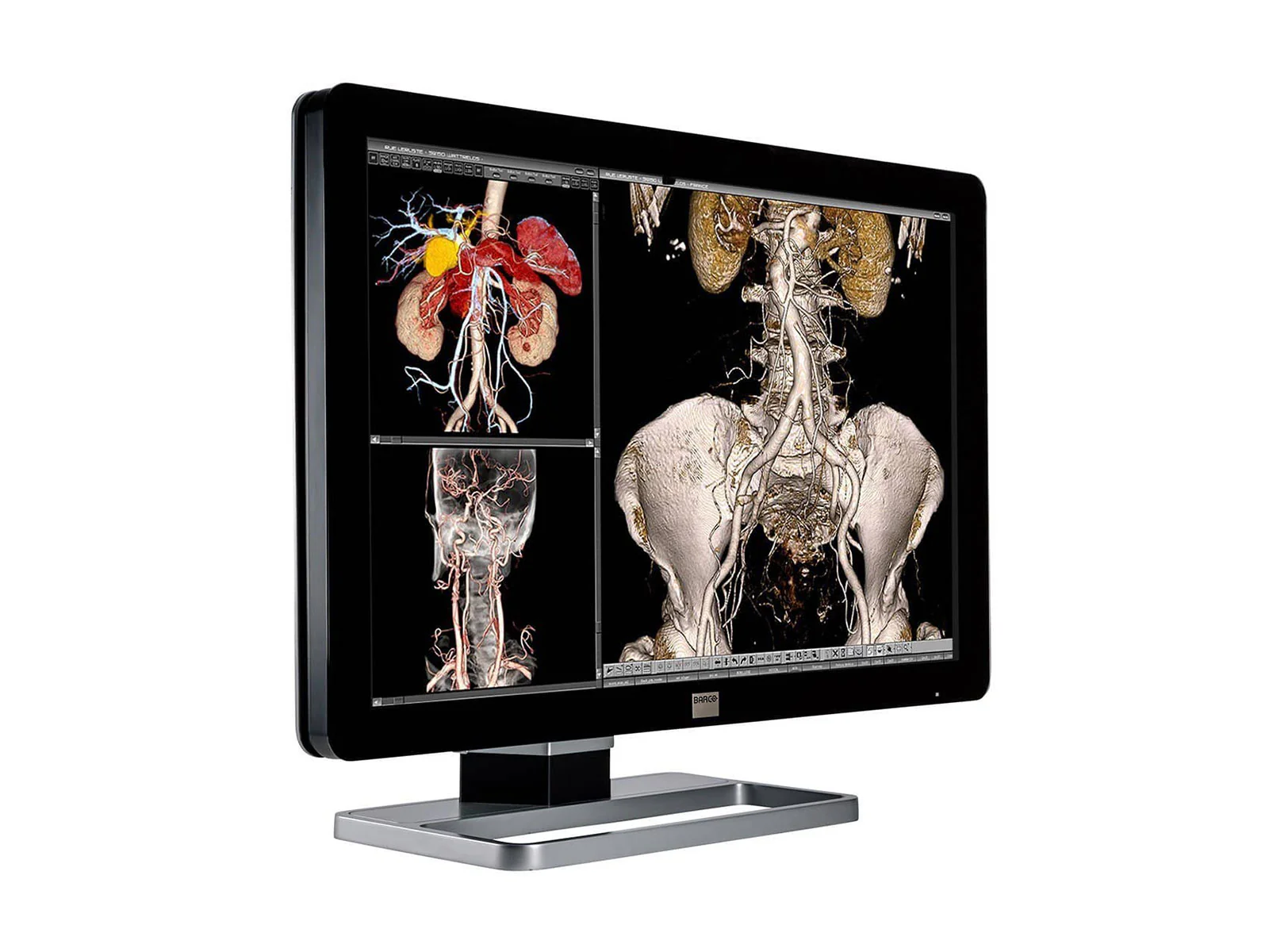 Barco Coronis Fusion MDCC-6230 6MP 30" Color General Radiology PACS Display - Image 3