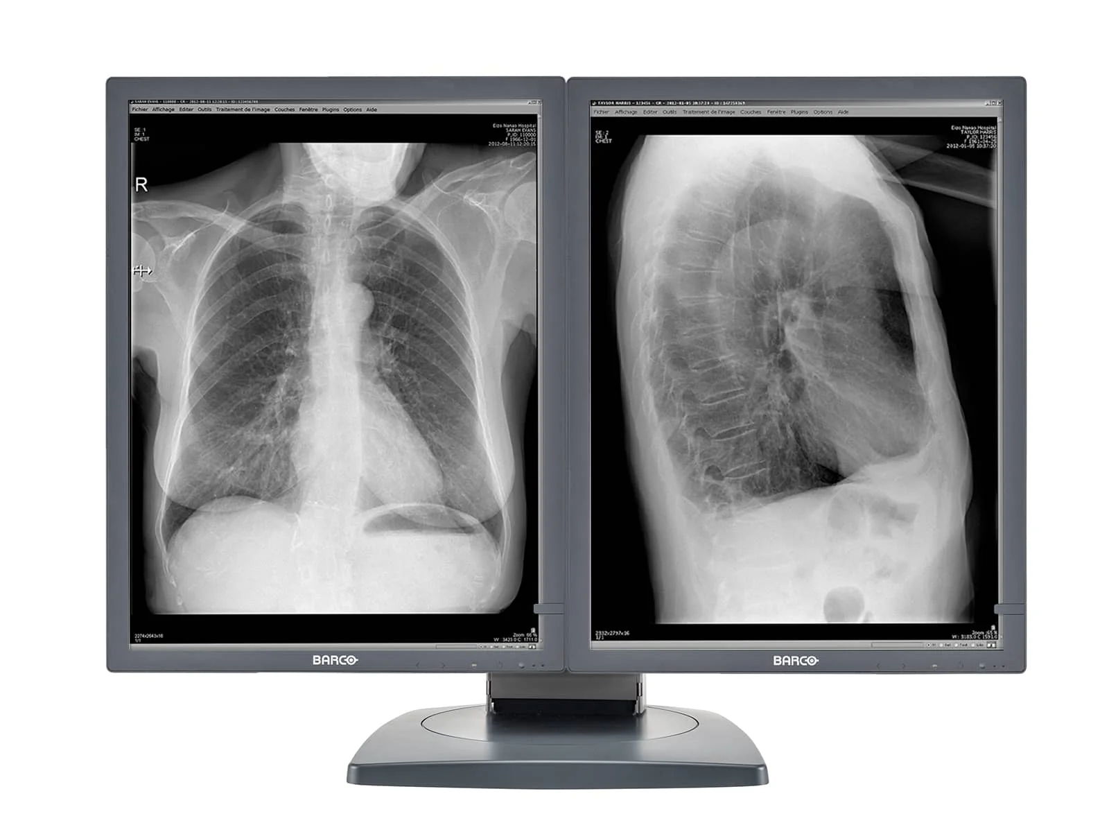 Barco Coronis MDCG-2121 2MP 21" Grayscale Diagnostic Radiology PACS Monitor - Image 4