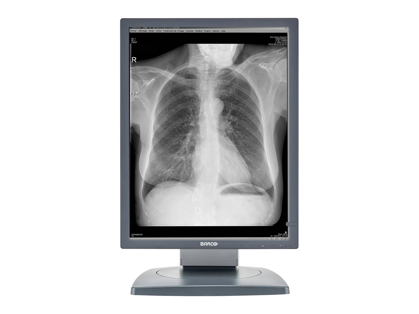 Barco Coronis MDCG-2121 2MP 21" Grayscale Diagnostic Radiology PACS Monitor - Image 5