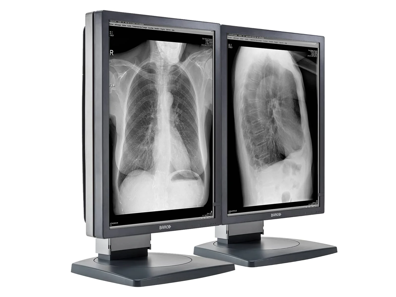 Barco Coronis MDCG-3120 3MP 20.8" Grayscale General Radiology Diagnostic Display - Image 2