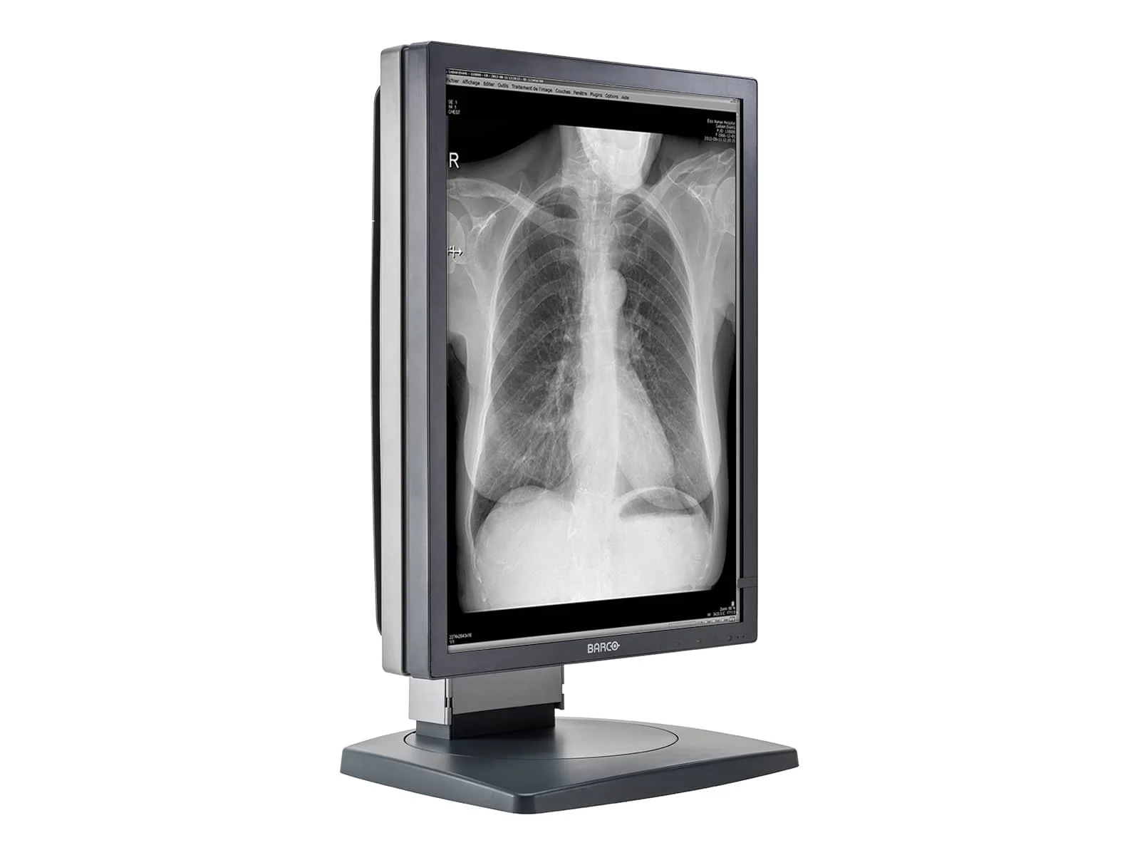 Barco Coronis MDCG-3120 3MP 20.8" Grayscale General Radiology Diagnostic Display - Image 6