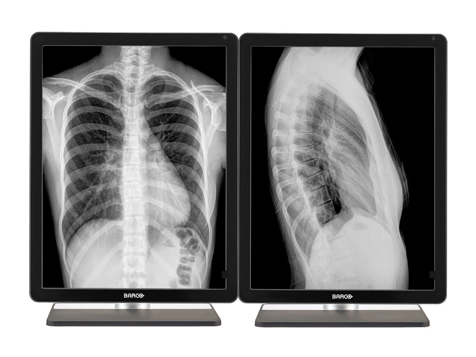 Barco Coronis MDCG-3221 3MP 21" Grayscale General Radiology Diagnostic Display