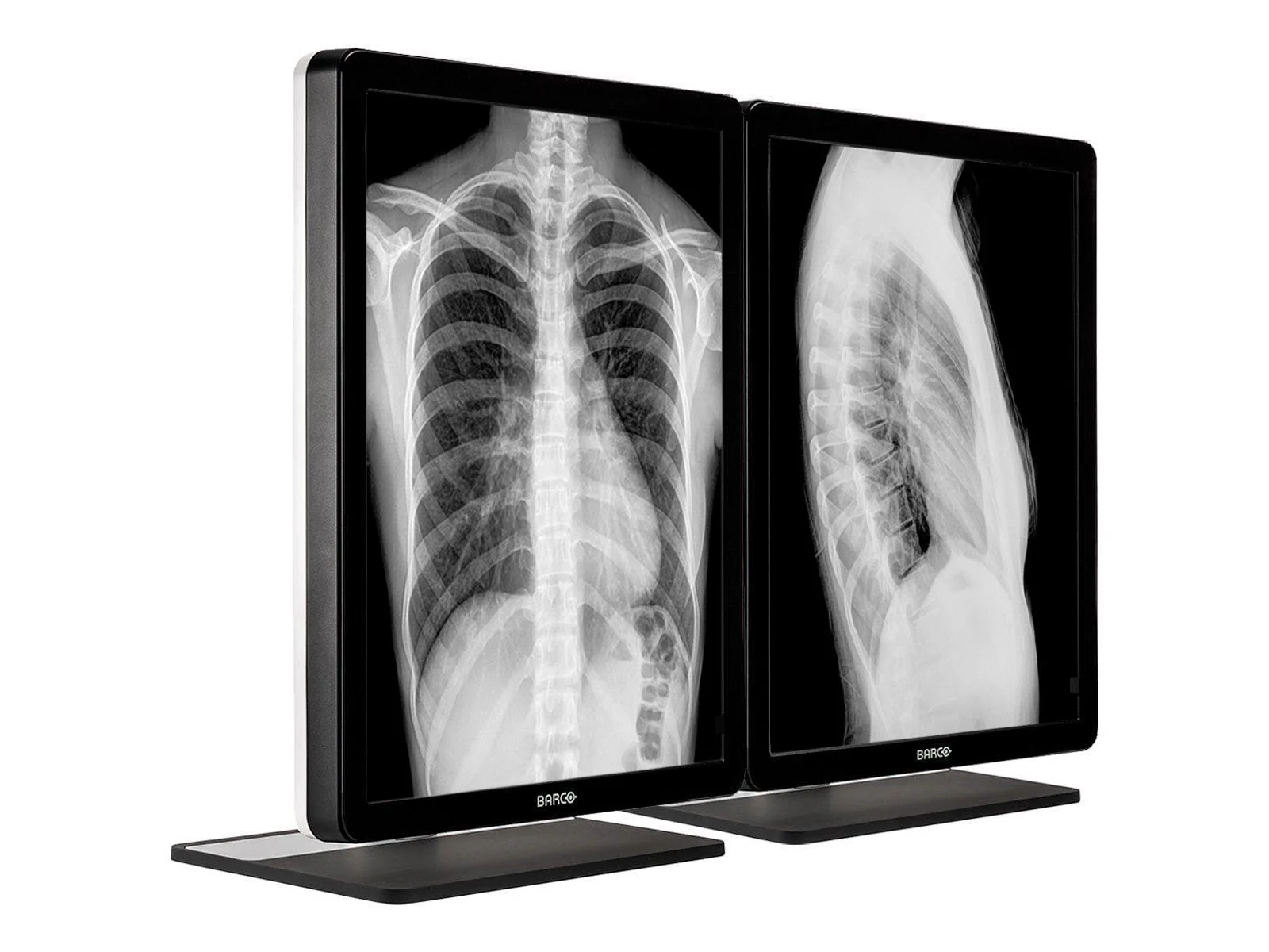 Barco Coronis MDCG-3221 3MP 21" Grayscale General Radiology Diagnostic Display - Image 2