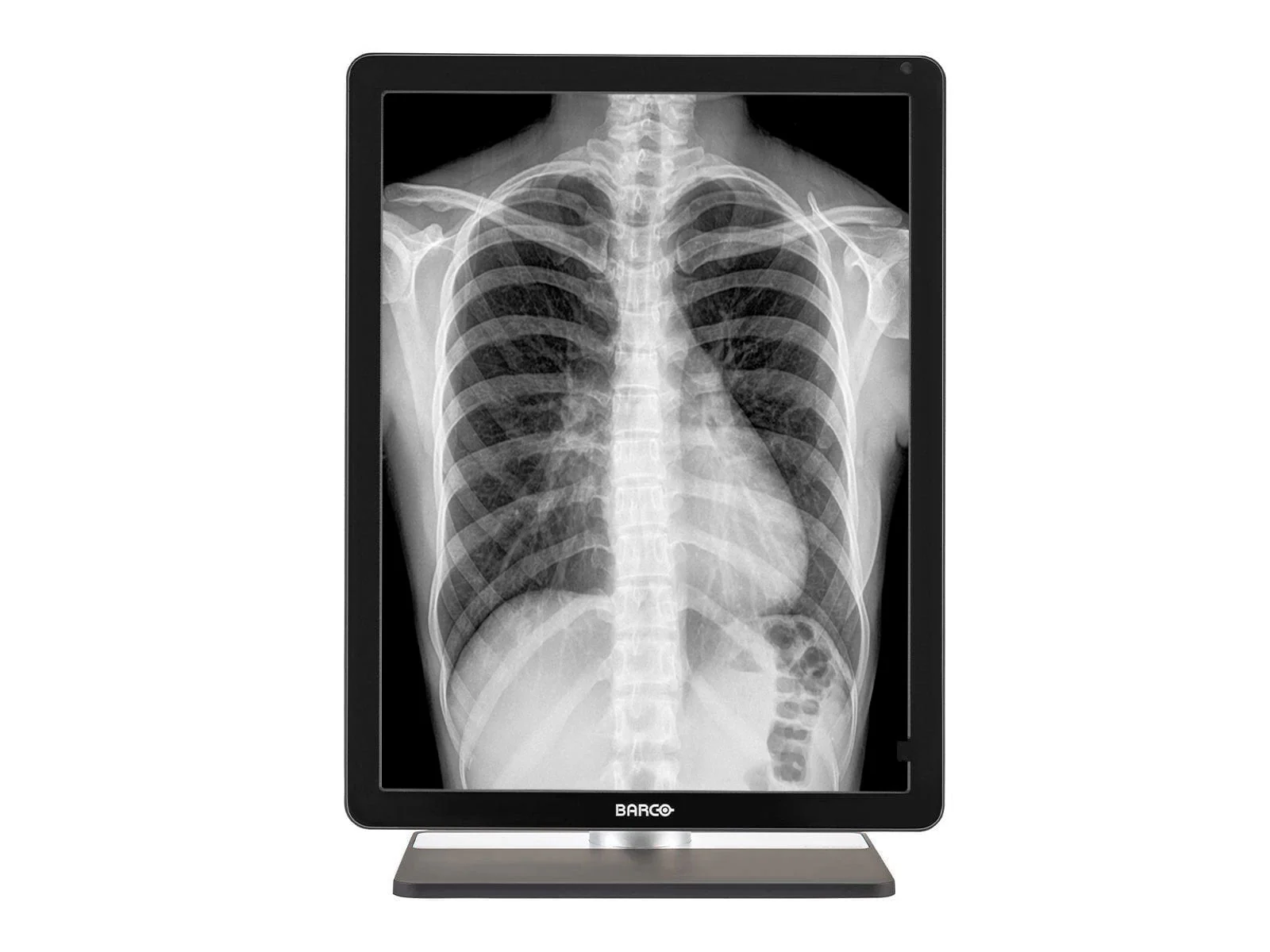 Barco Coronis MDCG-3221 3MP 21" Grayscale General Radiology Diagnostic Display - Image 3
