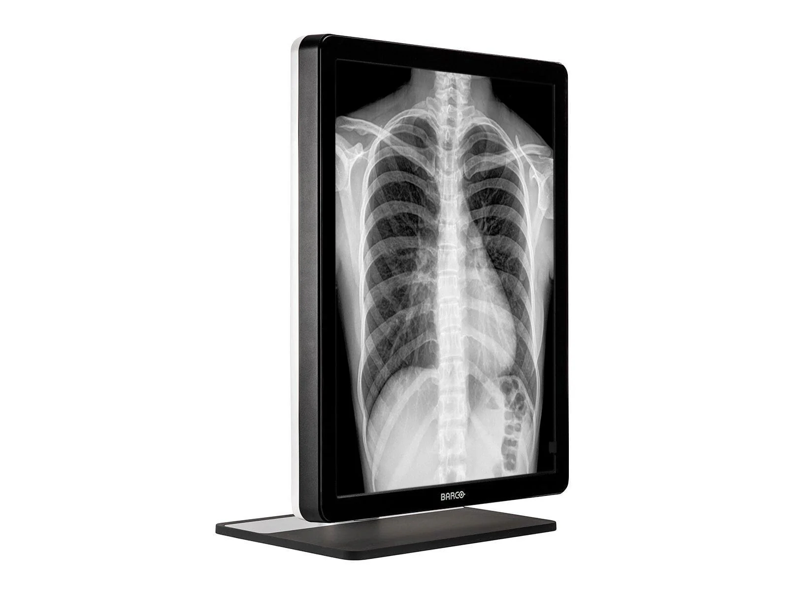 Barco Coronis MDCG-3221 3MP 21" Grayscale General Radiology Diagnostic Display - Image 4