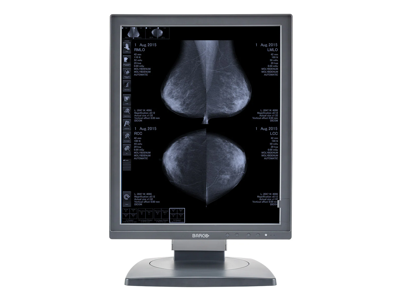 Barco Coronis MDCG-5121 5MP 21" Grayscale Mammo 3D-DBT Breast Imaging Display Monitor - Image 2