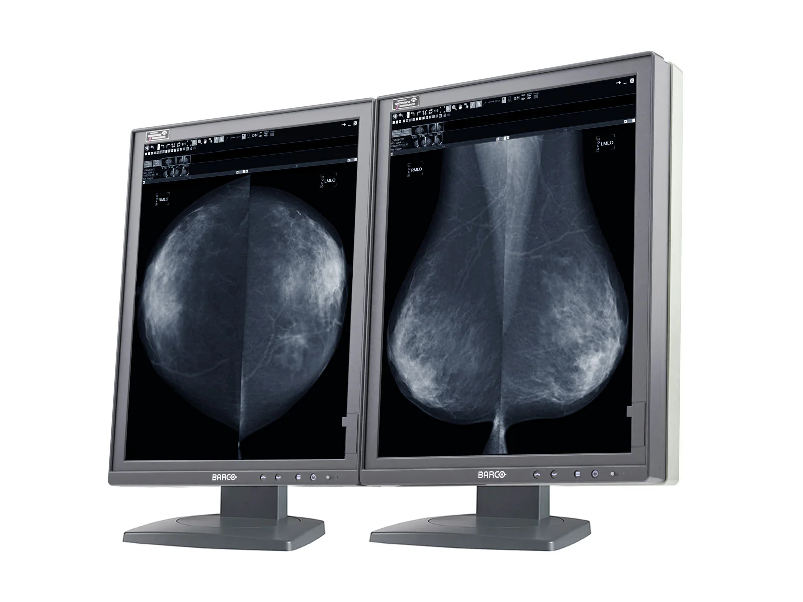 Barco Coronis MDMG-5221 5MP 21" Grayscale Tomosynthesis 3D-DBT Mammography Display - Image 3