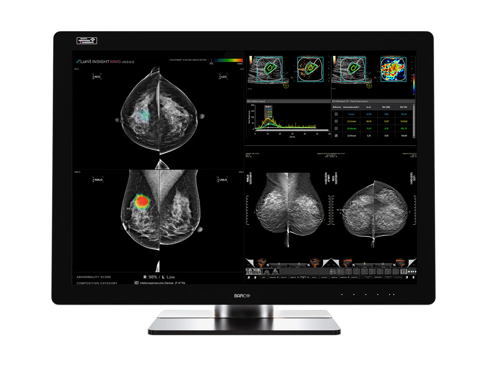 Barco Coronis UNITI MDMC-12133 12MP 33" Tomo Color Mammo 3D DBT PACS Display