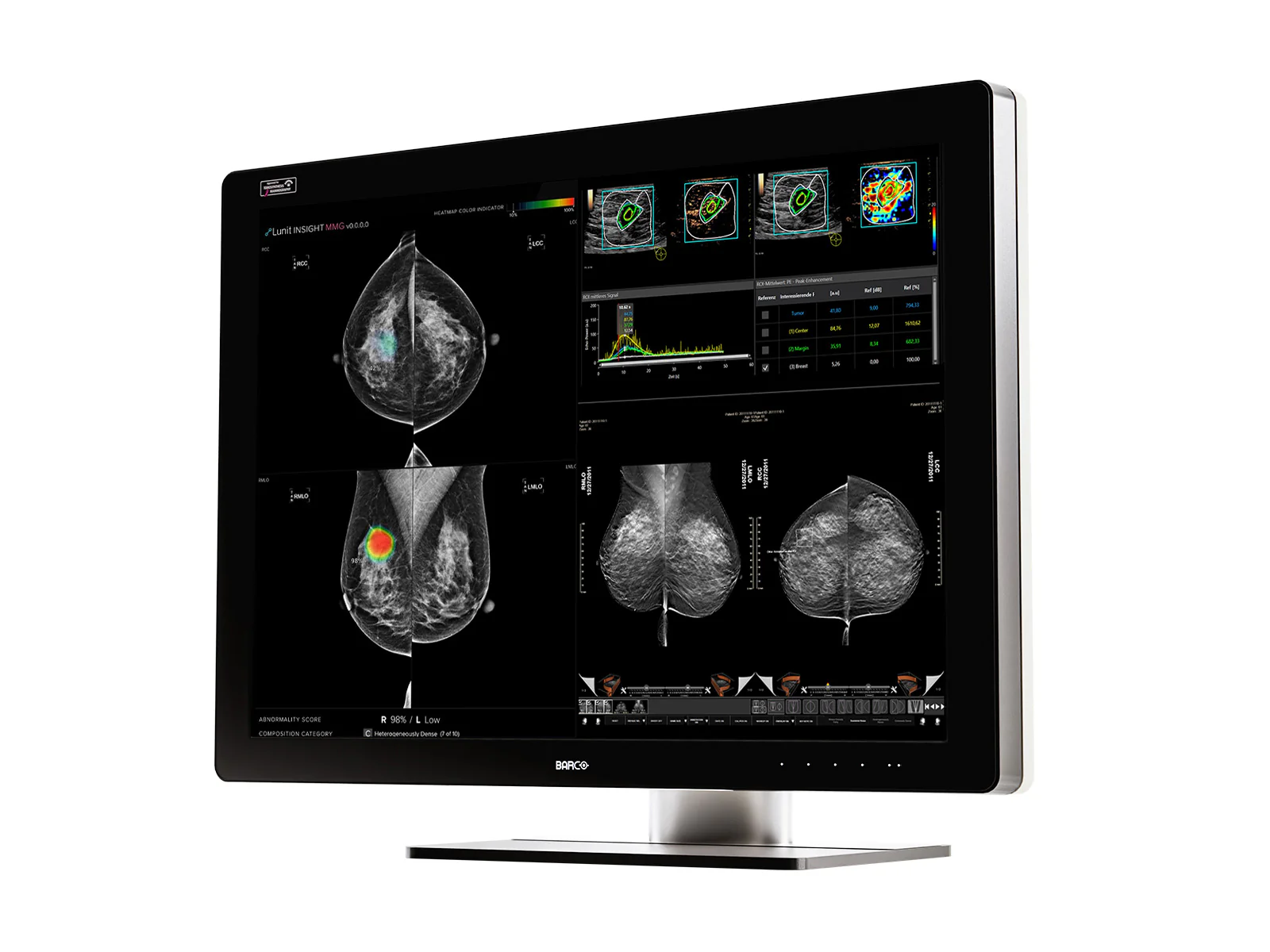 Barco Coronis UNITI MDMC-12133 12MP 33" Tomo Color Mammo 3D DBT PACS Display - Image 2