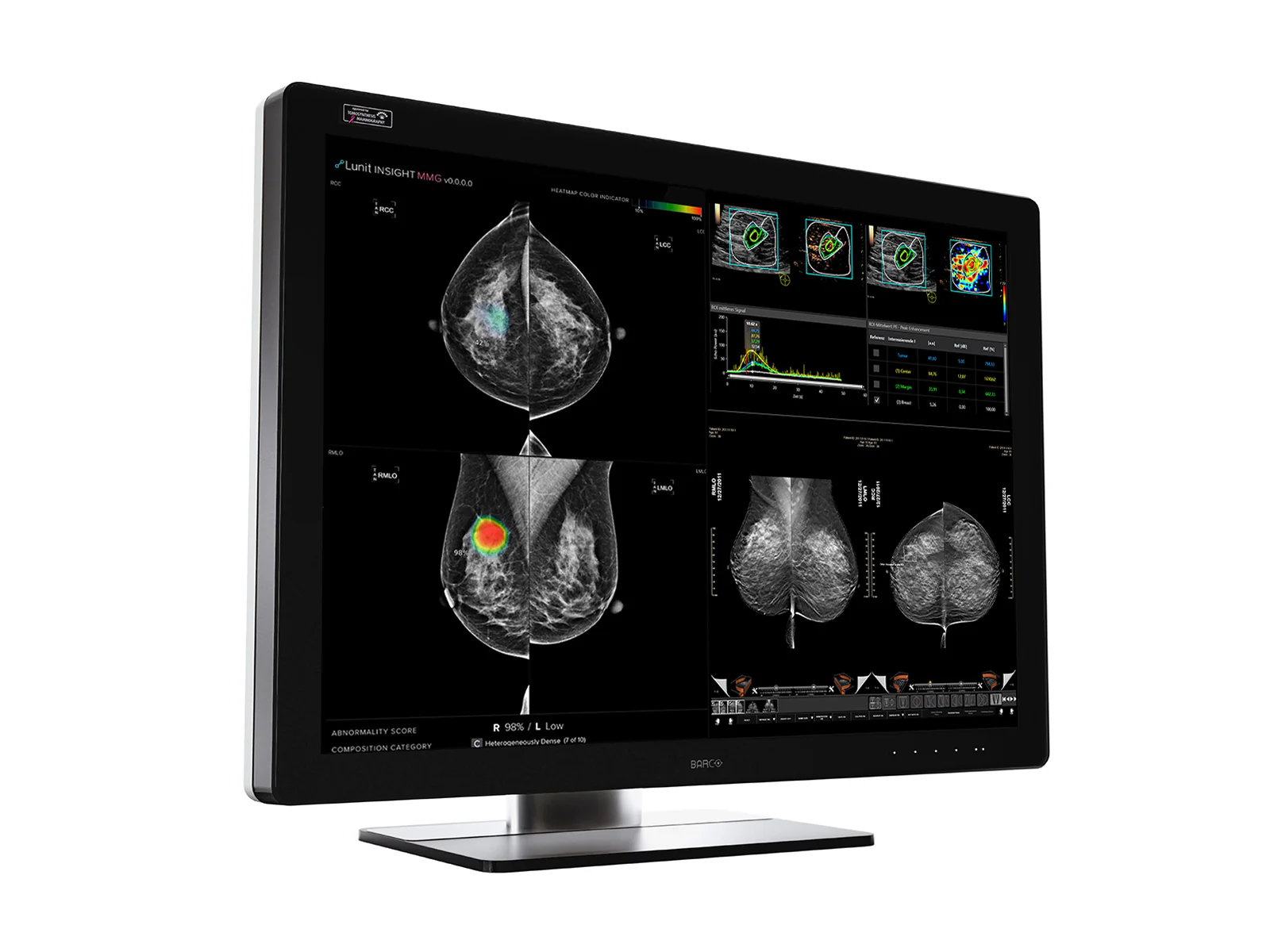 Barco Coronis UNITI MDMC-12133 12MP 33" Tomo Color Mammo 3D DBT PACS Display - Image 3