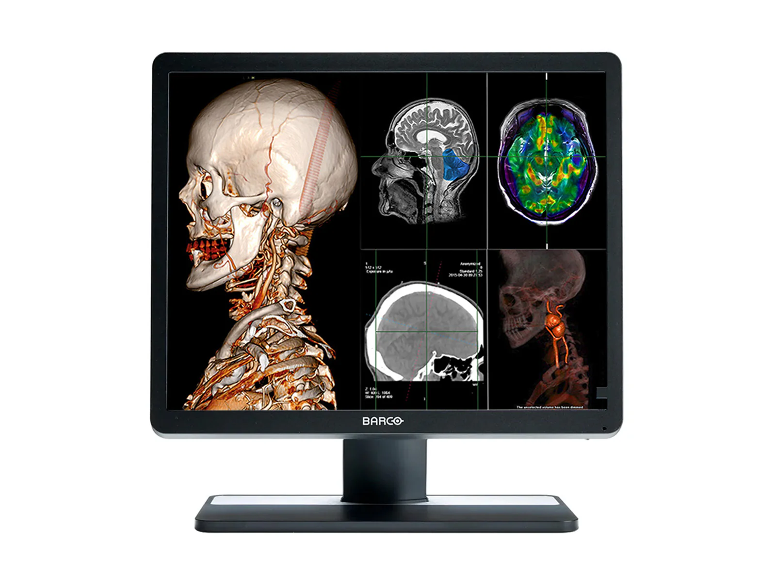 Barco Eonis MDRC-1419 SNIB 1MP 19" (1280 x 1024) 5:4 Color Clinical Review Display Monitor