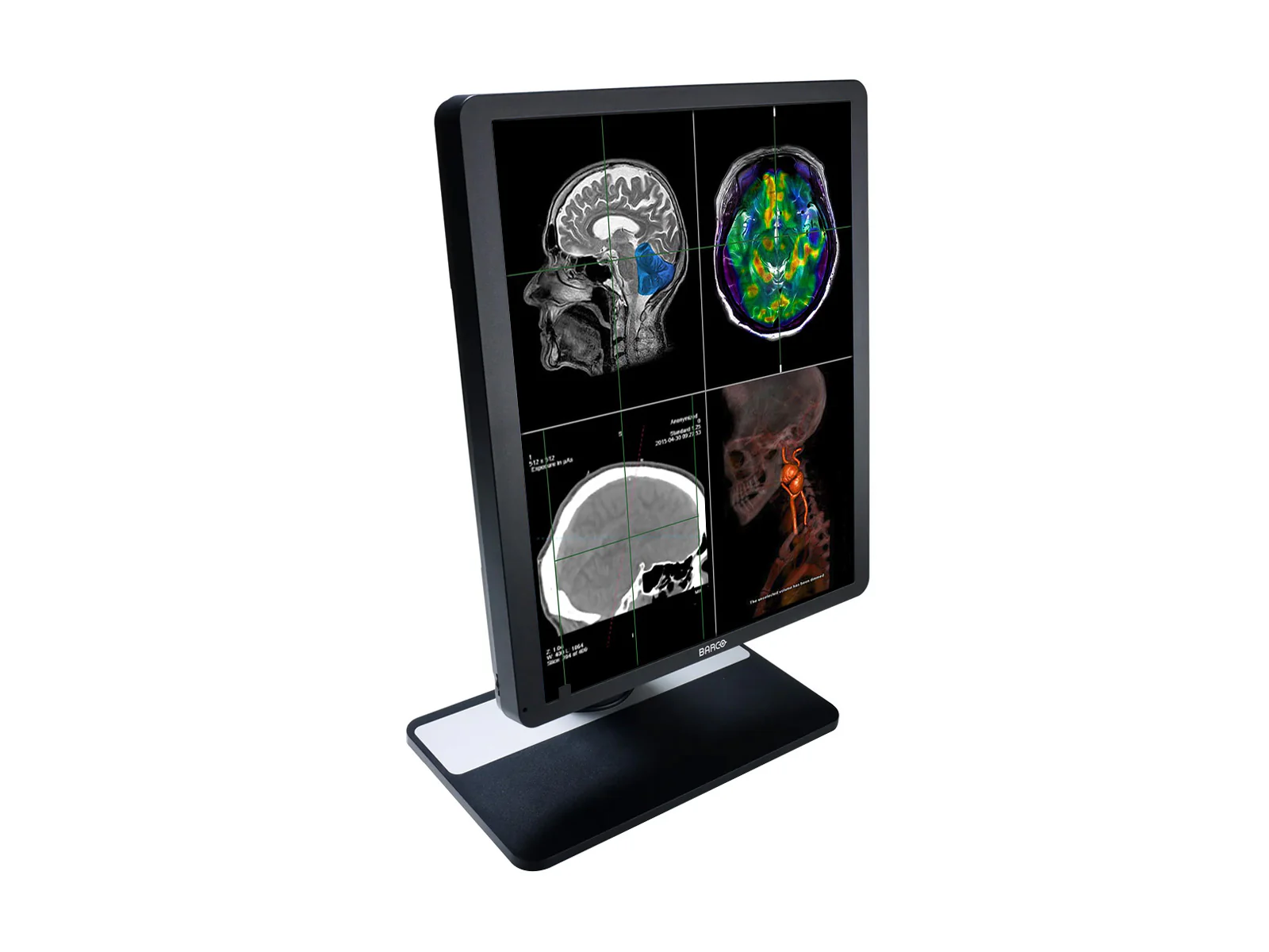 Barco Eonis MDRC-1419 SNIB 1MP 19" (1280 x 1024) 5:4 Color Clinical Review Display Monitor - Image 2