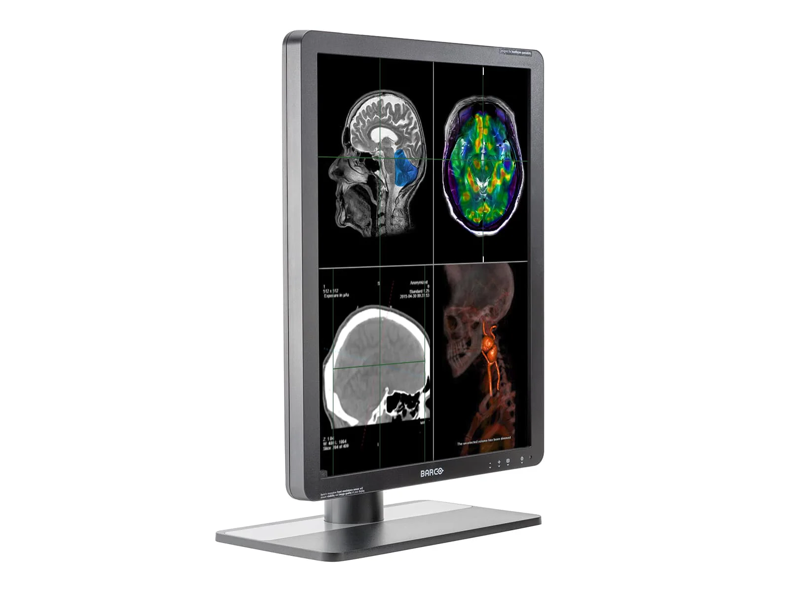 Barco Eonis MDRC-2221 2MP 21" Color Clinical Review Display Monitor - Image 3
