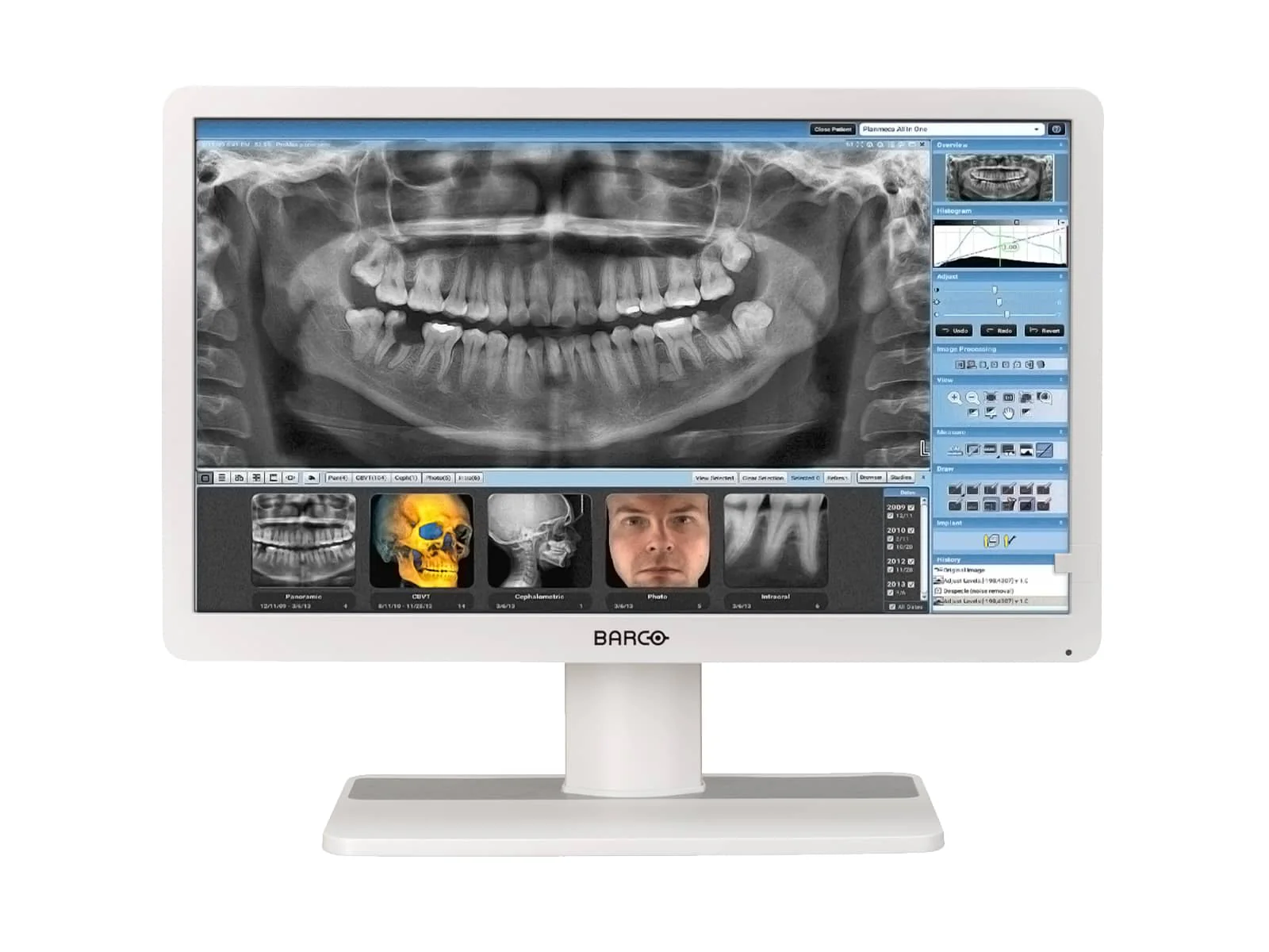 Barco Eonis MDRC-2222 WP 2MP 22" Clinical Review Monitor (K9307945)