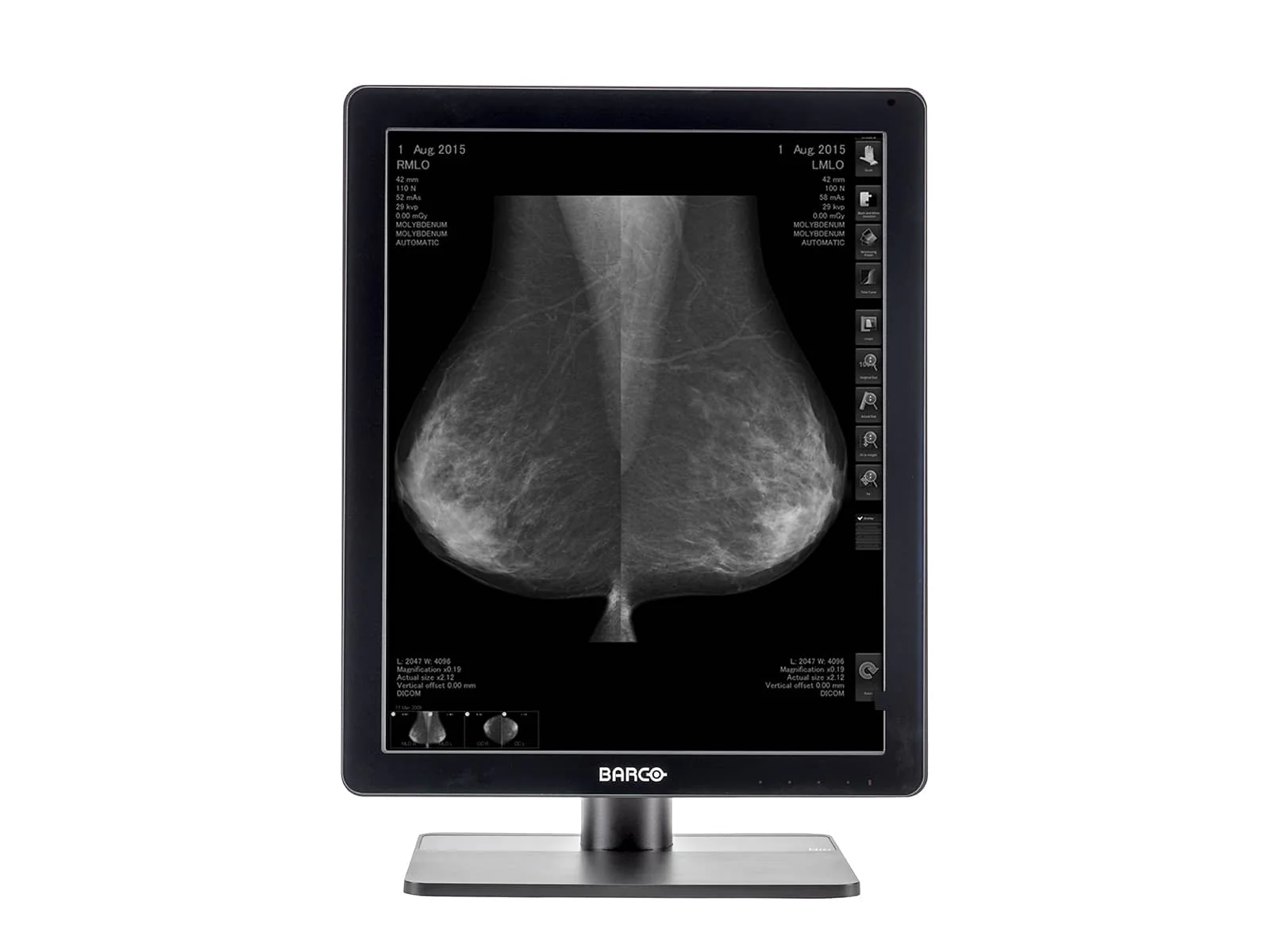Barco Nio MDNG-5221 5MP 21" Grayscale 3D-DBT Mammography Breast Imaging PACS Display - Image 3