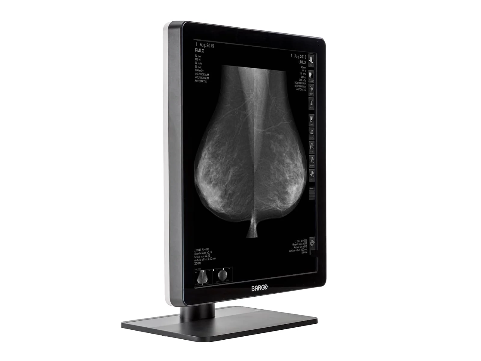 Barco Nio MDNG-5221 5MP 21" Grayscale 3D-DBT Mammography Breast Imaging PACS Display - Image 4