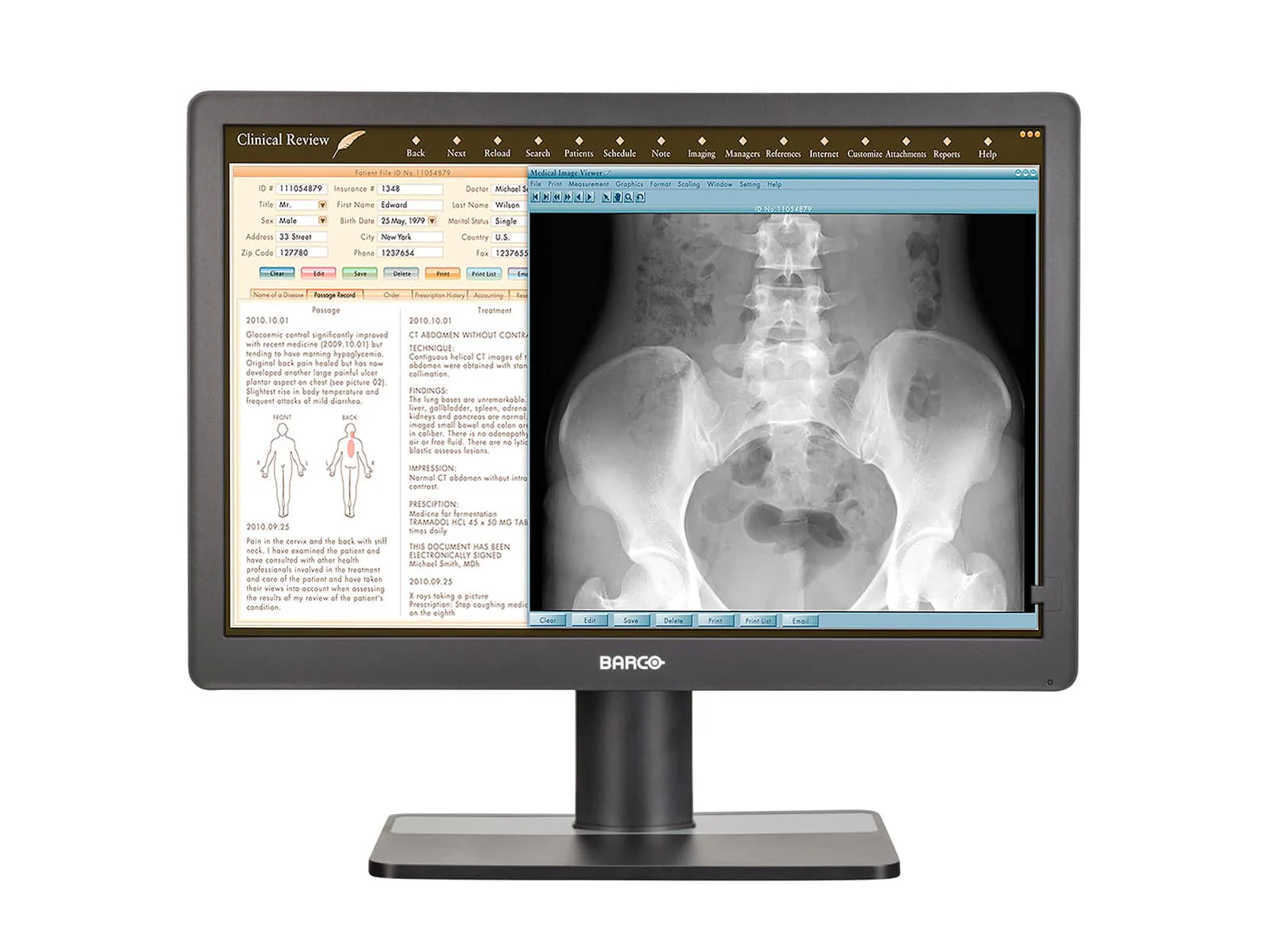 Barco Eonis MDRC-2222 Full HD 1080P 22" 2MP Clinical Review Monitor