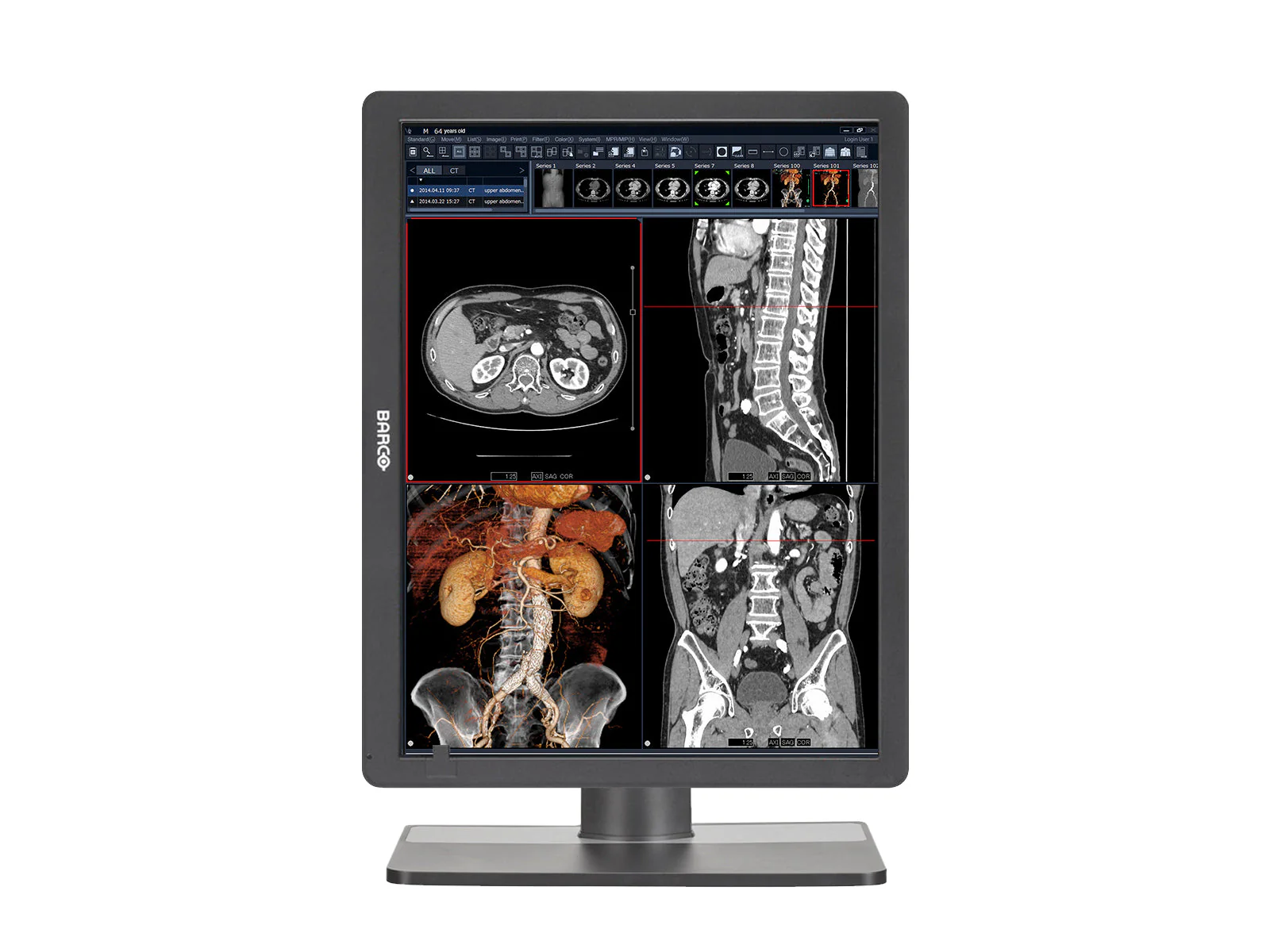 Barco Eonis MDRC-2321 2MP 21" Color Clinical Review Display - Image 2