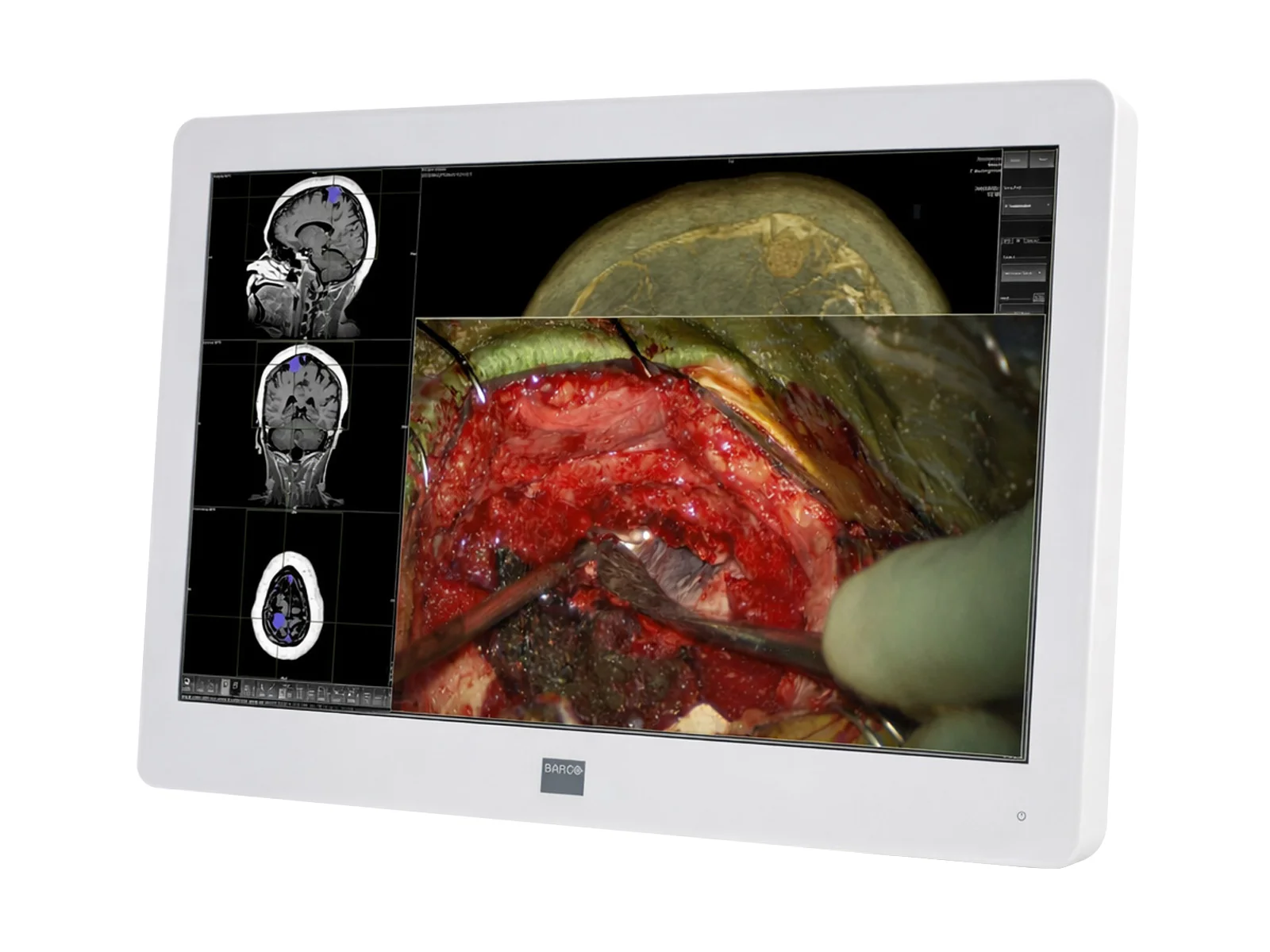 Barco MDSC-2224 MNA 24" 2MP FHD 1920 x 1200 Surgical Endoscopy Medical Display Monitor (K9307913) - Image 2