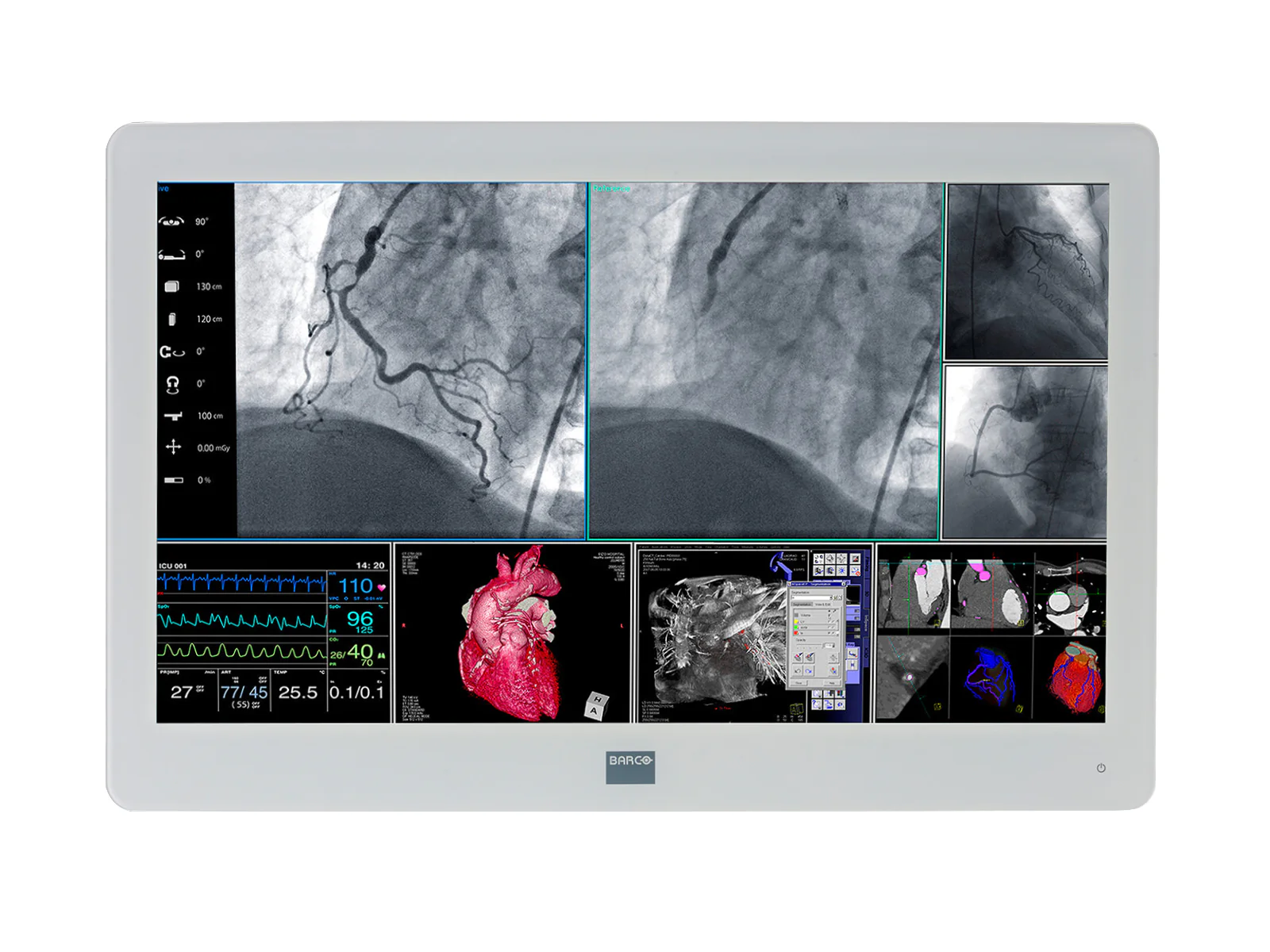 Barco MDSC-2226 LED 26" 2MP Full HD Surgical Medical Display Monitor (K9307906)
