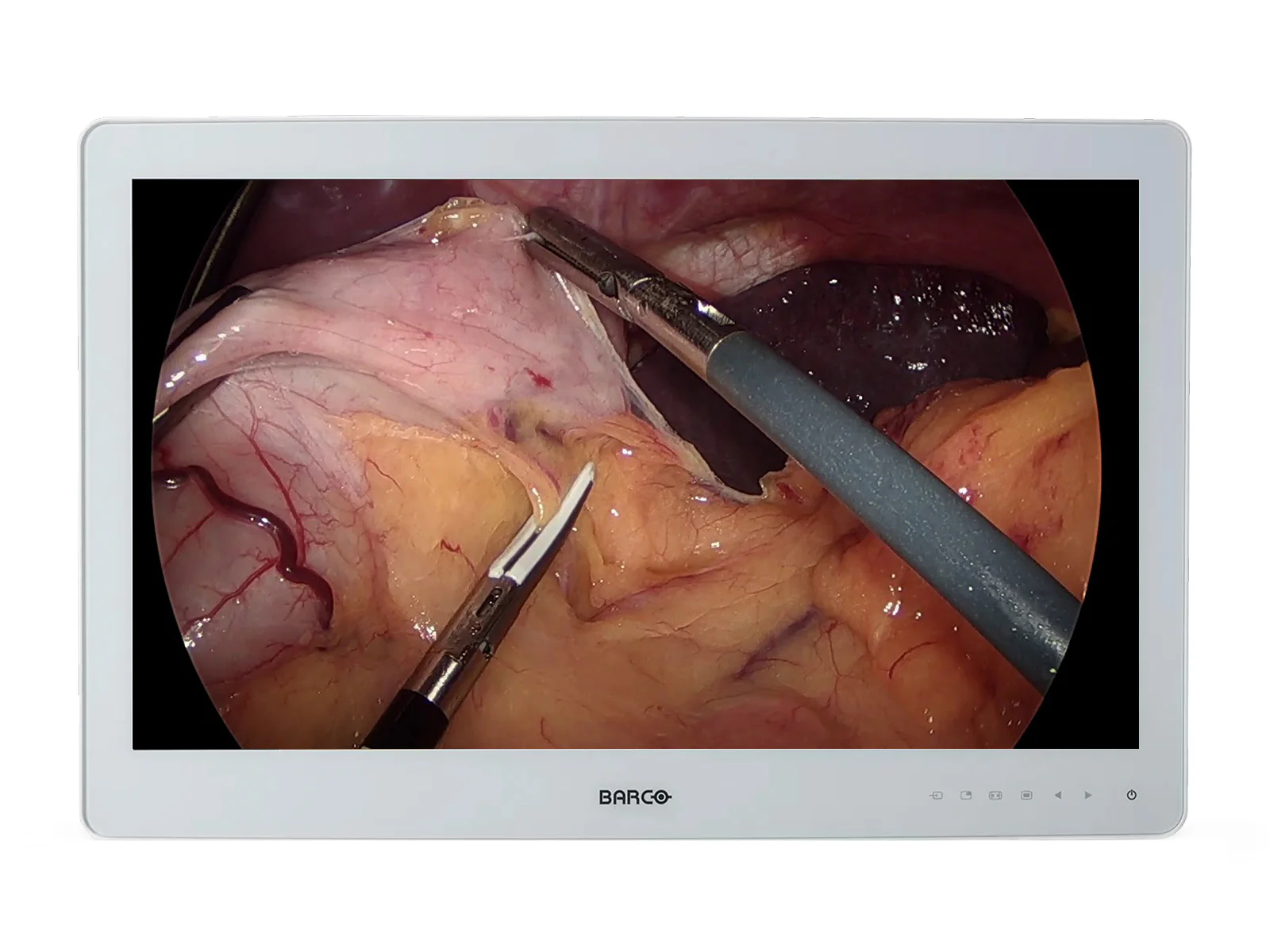 Barco MDSC-2326 LED 26" 2MP Full HD Surgical Medical Display Monitor (K9307951)