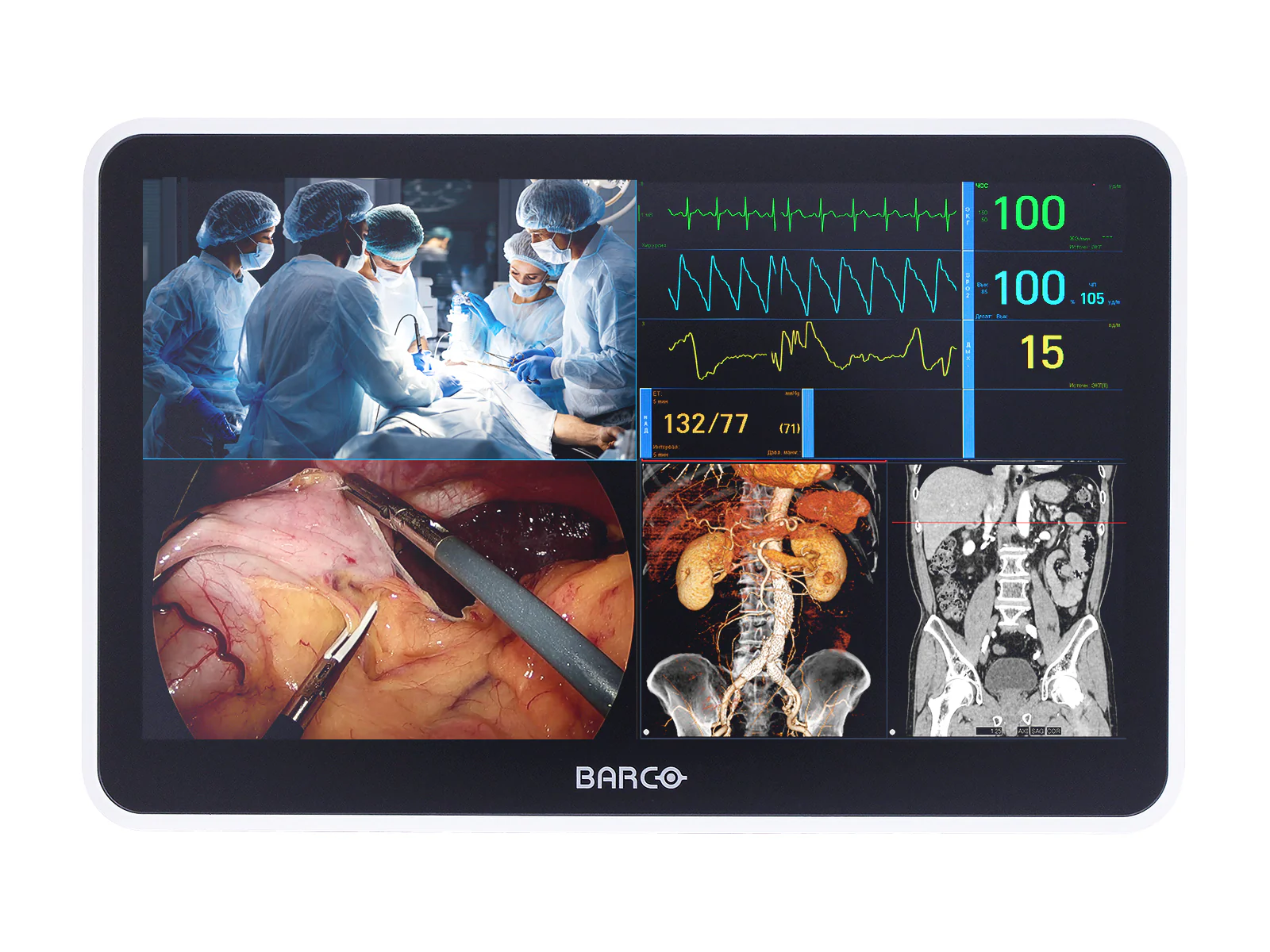 Barco MUIP-2112 12.5" Color Clinical Review Multi-touch Screen Monitor
