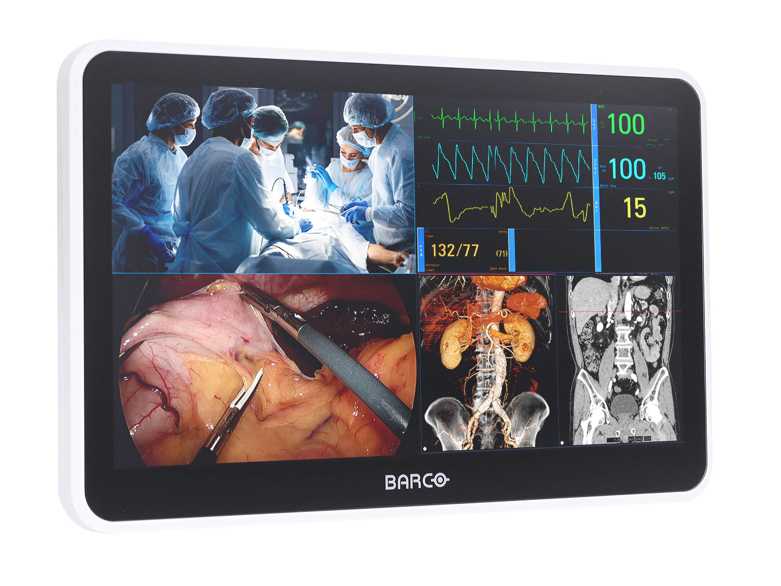 Barco MUIP-2112 12.5" Color Clinical Review Multi-touch Screen Monitor - Image 2