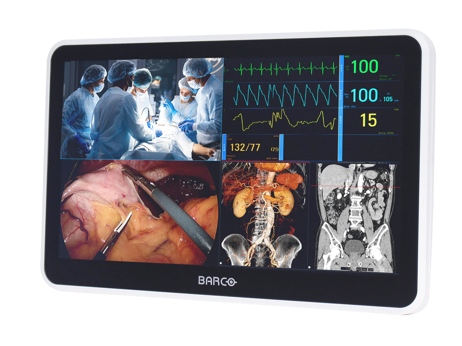 Barco MUIP-2112 12.5" Color Clinical Review Multi-touch Screen Monitor - Image 3