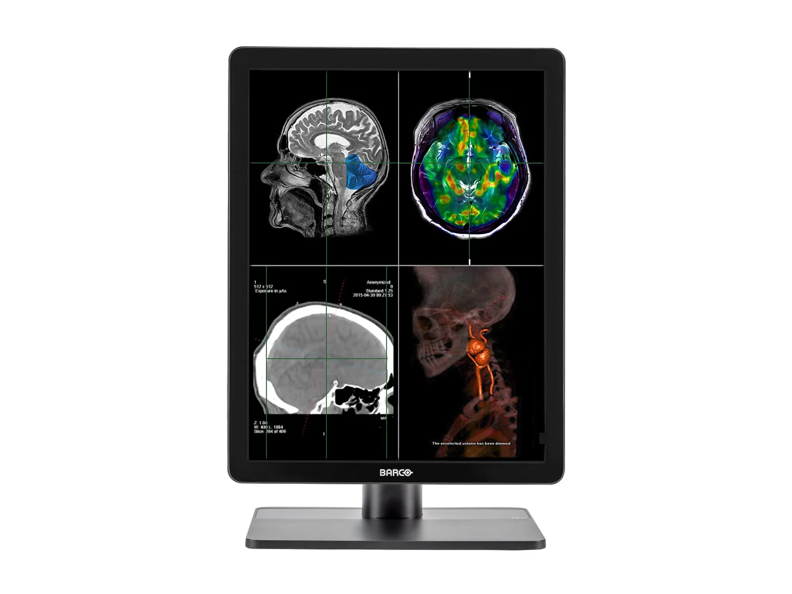 Barco Nio MDNC-2221 2MP 21" Color Diagnostic Radiology Display Monitor - Image 3