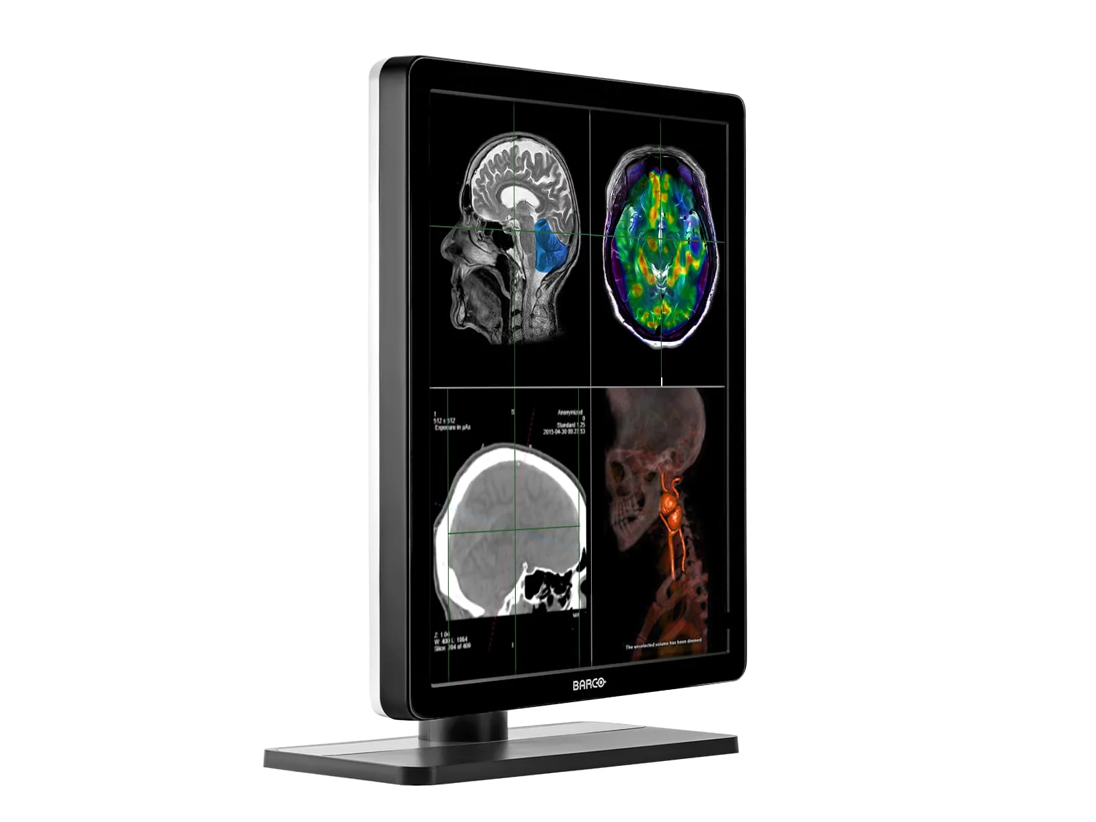 Barco Nio MDNC-2221 2MP 21" Color Diagnostic Radiology Display Monitor - Image 4