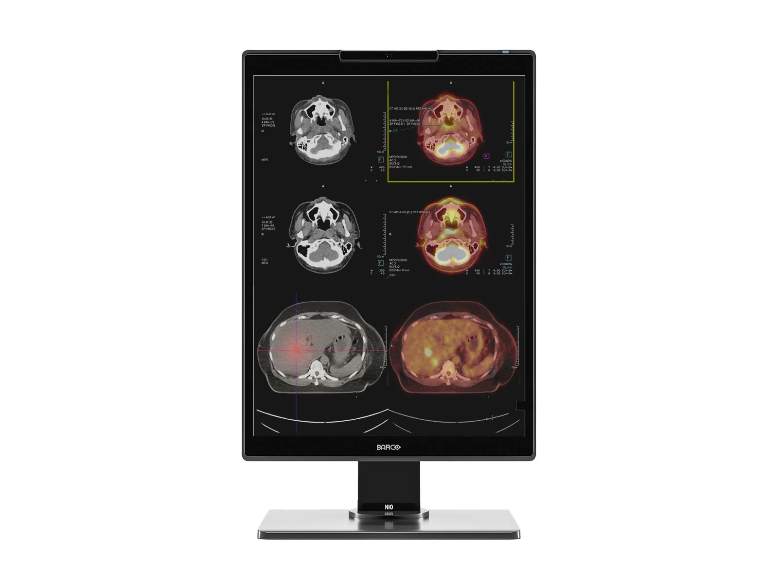 Barco Nio MDNC-2521 2MP 21" Color Diagnostic Radiology Display Monitor