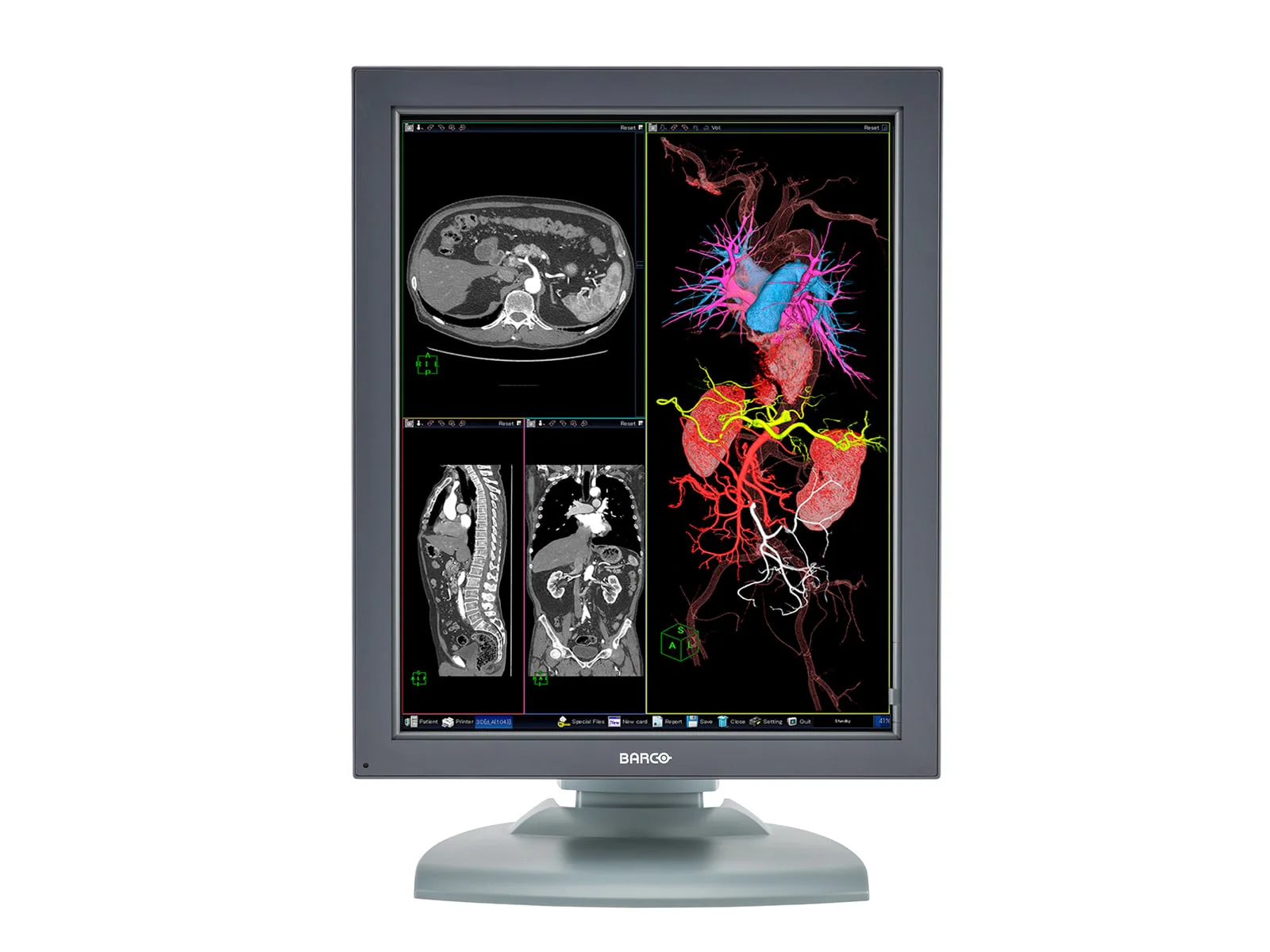 Barco Nio MDNC-3121 HighBright 3MP 21" Color Medical Diagnostic Radiology Monitor - Image 3