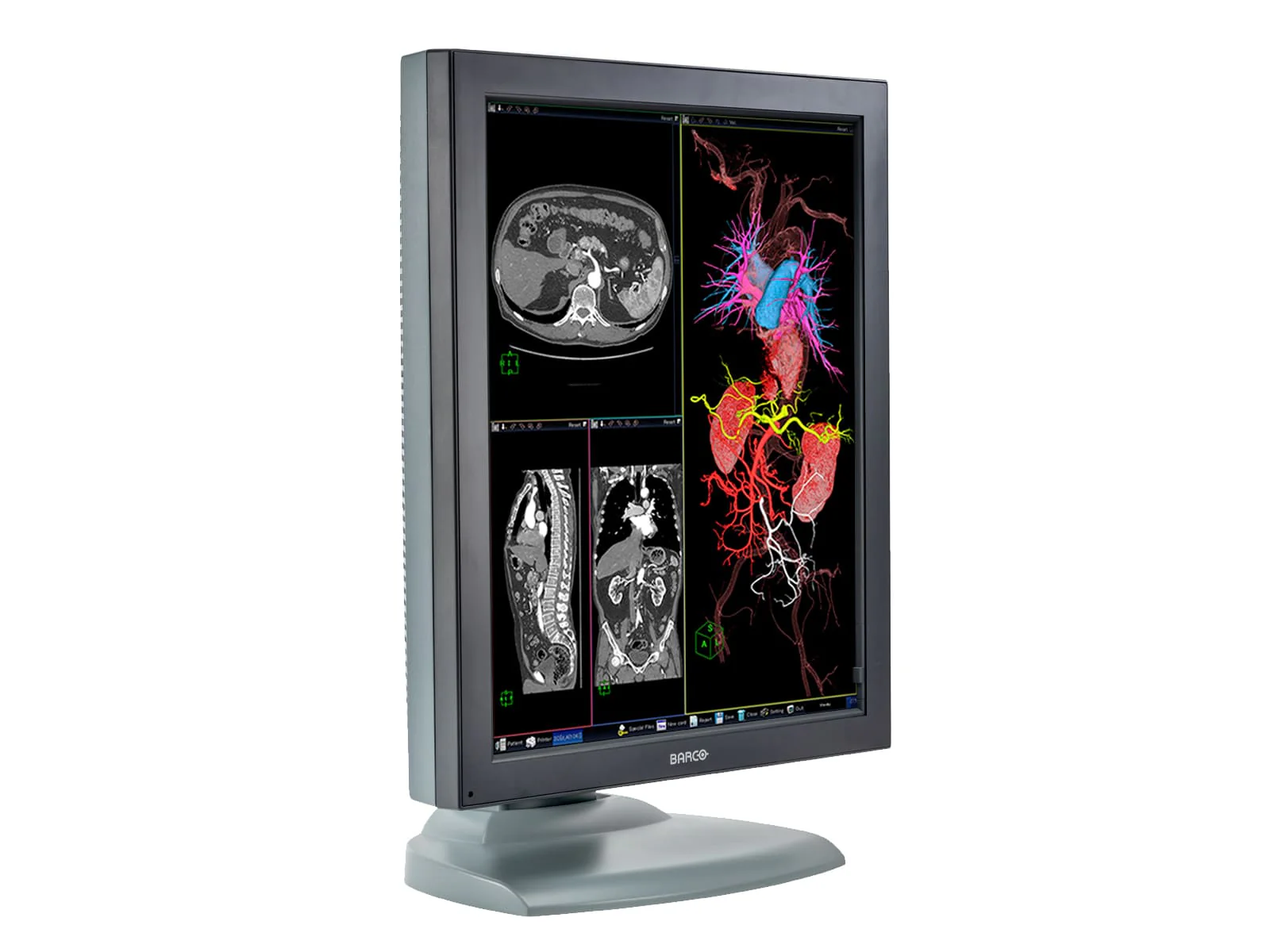 Barco Nio MDNC-3121 HighBright 3MP 21" Color Medical Diagnostic Radiology Monitor - Image 4