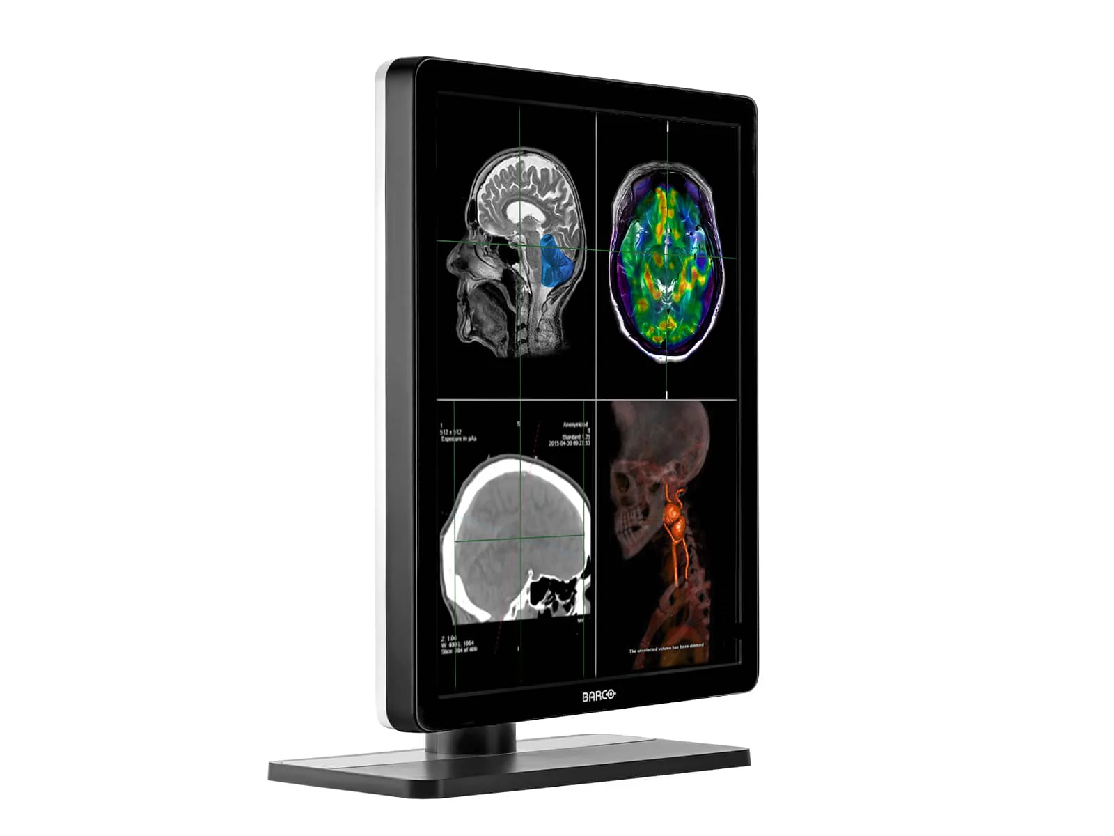 Barco Nio MDNC-3321 3MP 21" Color General Radiology Diagnostic PACS Display - Image 4