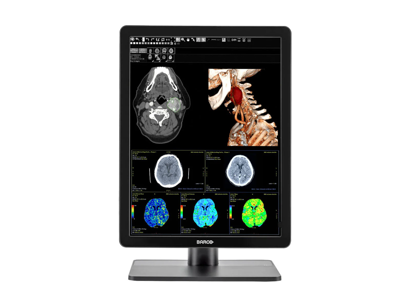 Pair (x2) Barco Nio MDNC-3421 3MP with 21" Color General Radiology Monitors with MXRT-6700 - Image 3