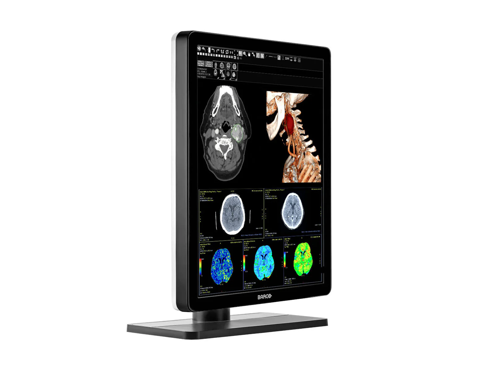Pair (x2) Barco Nio MDNC-3421 3MP with 21" Color General Radiology Monitors with MXRT-6700 - Image 4