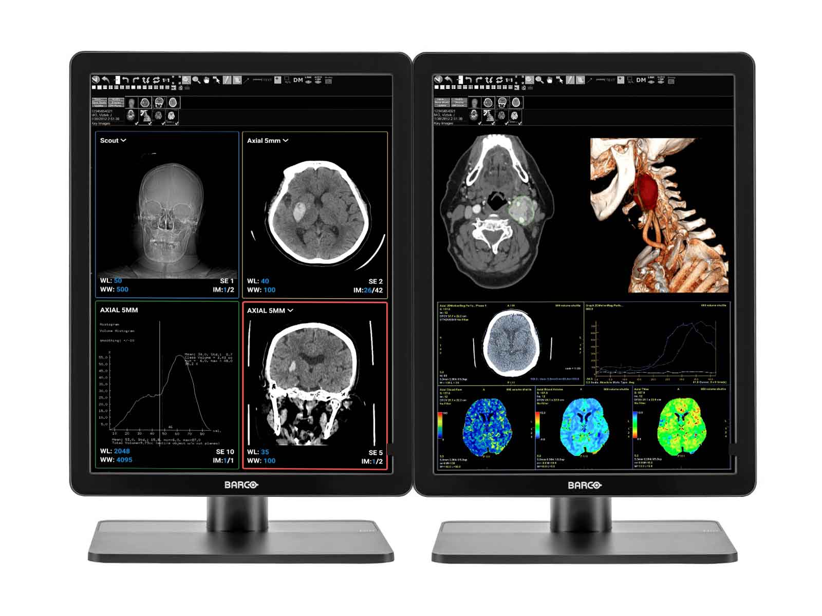 Pair (x2) Barco Nio MDNC-3421 3MP with 21" Color General Radiology Monitors with MXRT-6700 - Image 6
