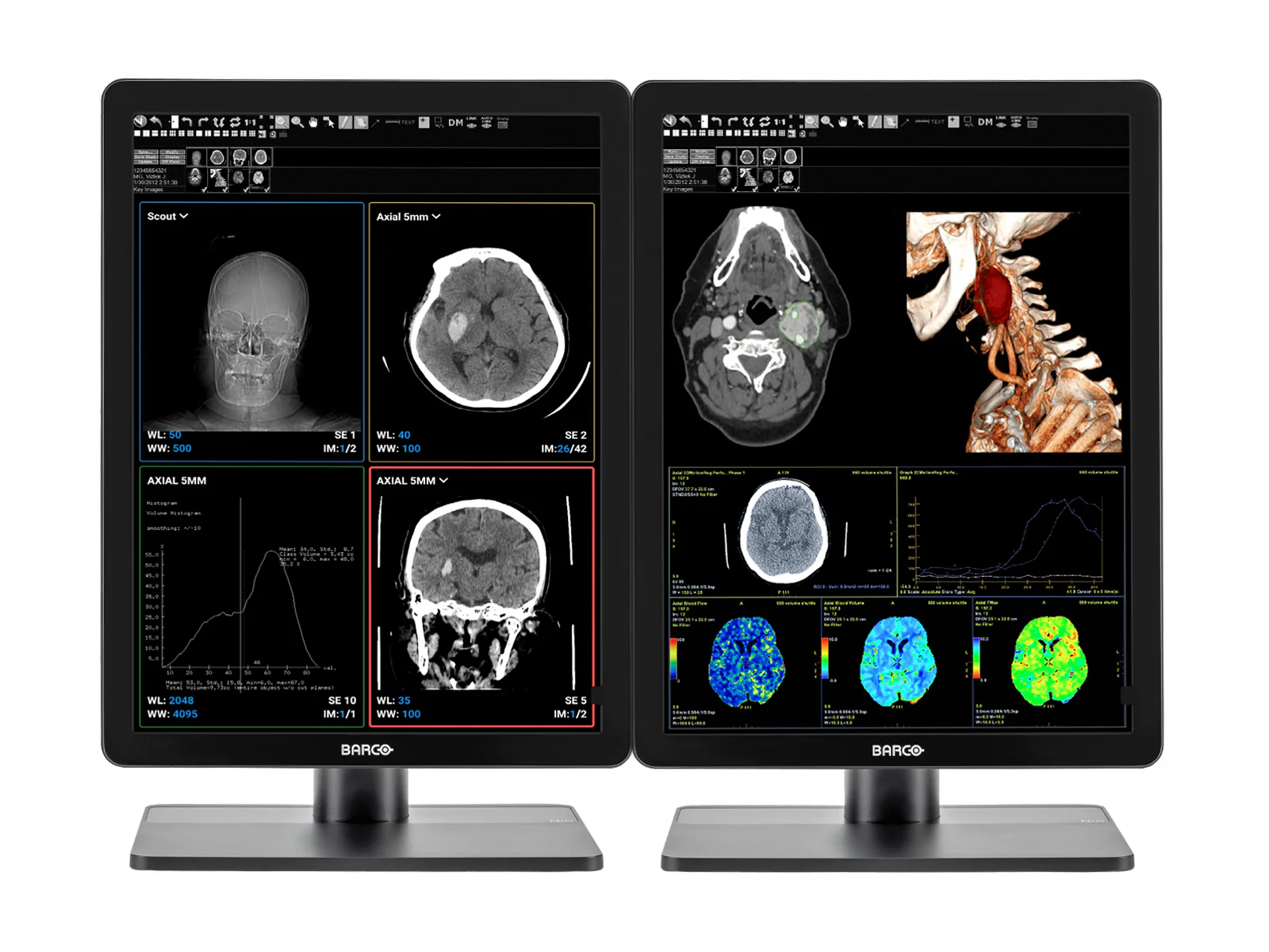 Pair (x2) Barco Nio MDNC-3421 3MP with 21" Color General Radiology Monitors with MXRT-6700 - Image 7