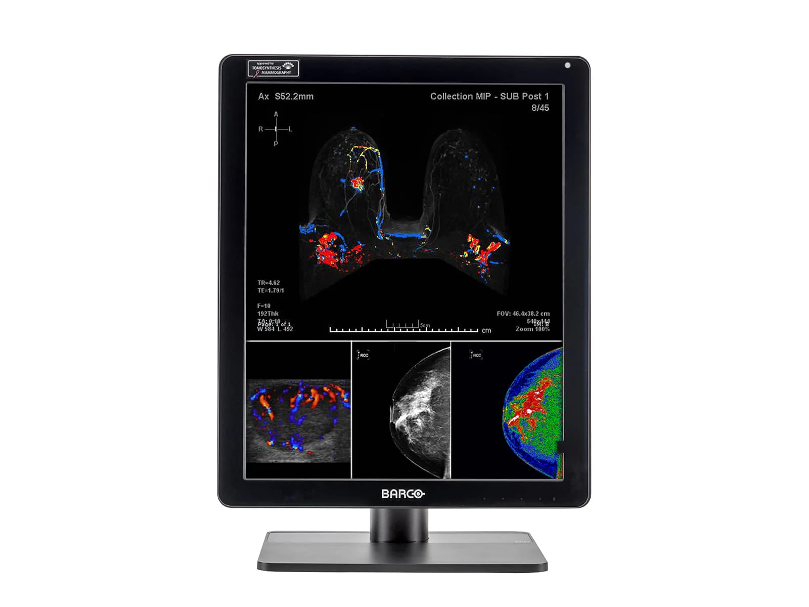 Barco Nio MDNC-6121 5MP 21" Color Mammo 3D-DBT Breast Imaging Display - Image 3