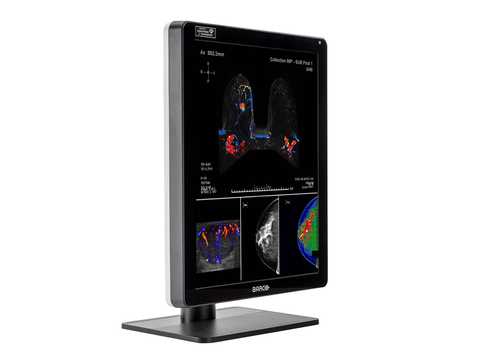 Barco Nio MDNC-6121 5MP 21" Color Mammo 3D-DBT Breast Imaging Display - Image 4