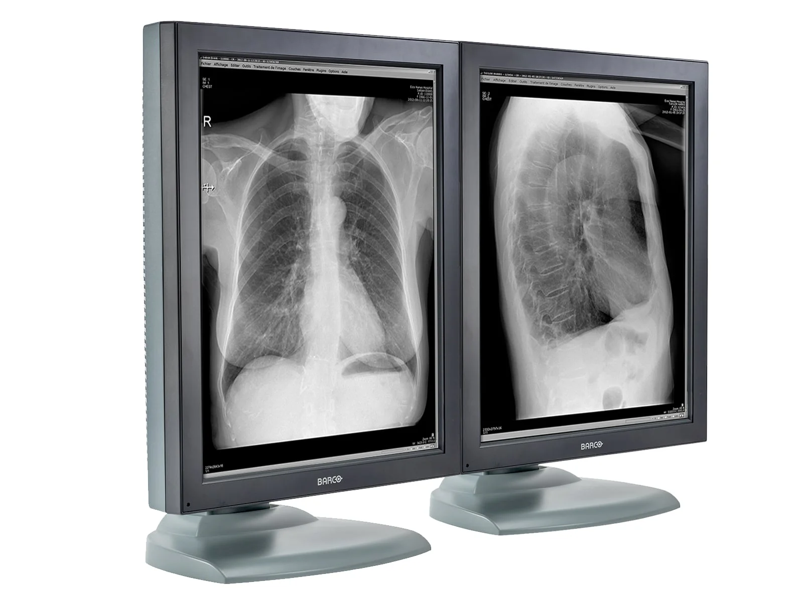 Barco Nio MDNG-2121 2MP 21" Grayscale Medical Diagnostic Radiology Monitor - Image 2