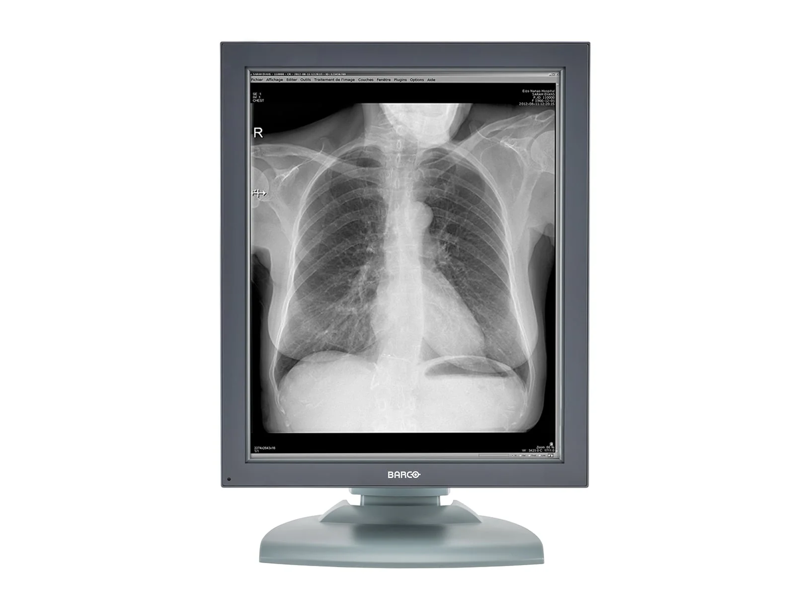 Barco Nio MDNG-2121 2MP 21" Grayscale Medical Diagnostic Radiology Monitor - Image 3