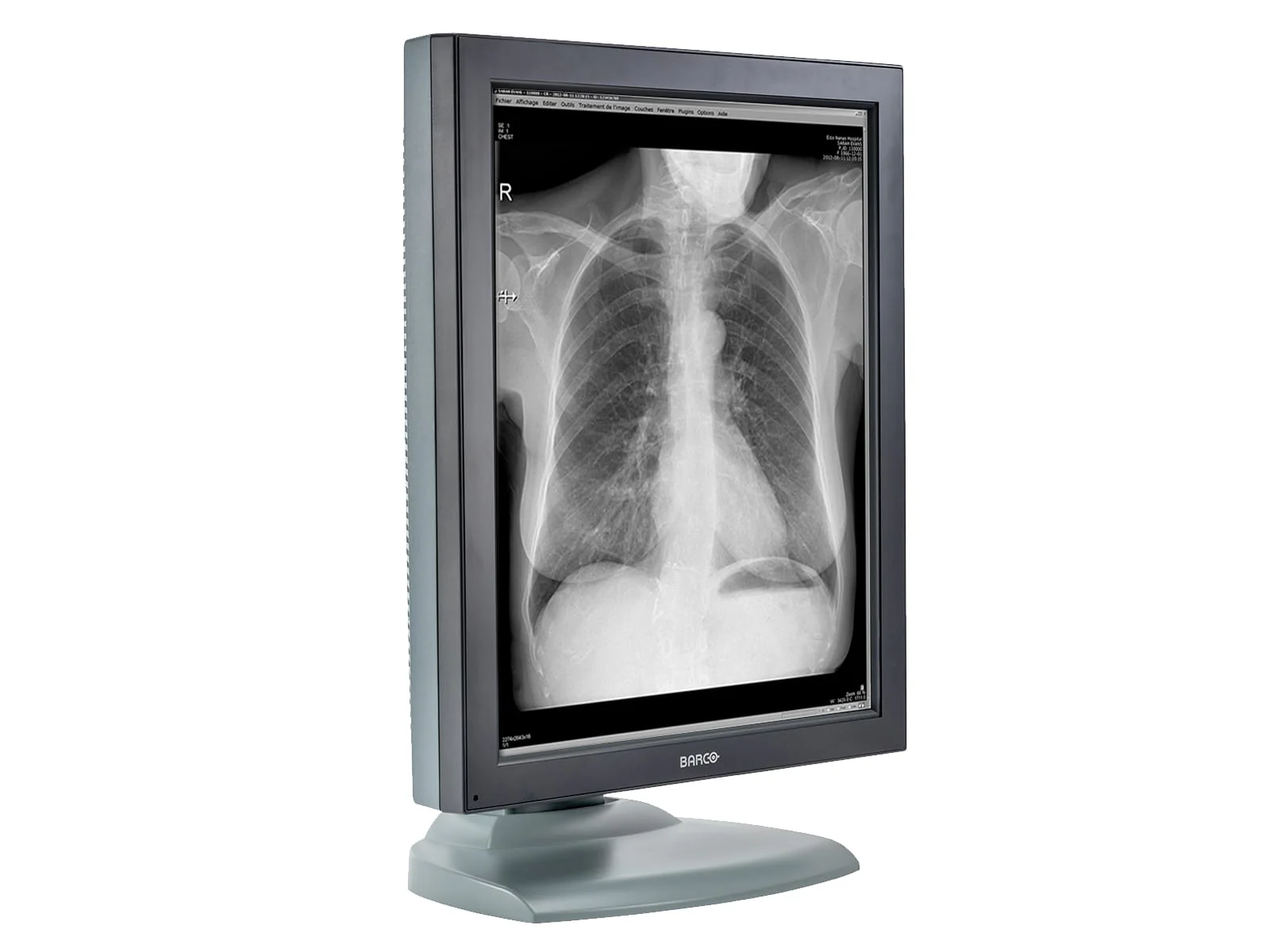 Barco Nio MDNG-2121 2MP 21" Grayscale Medical Diagnostic Radiology Monitor - Image 4
