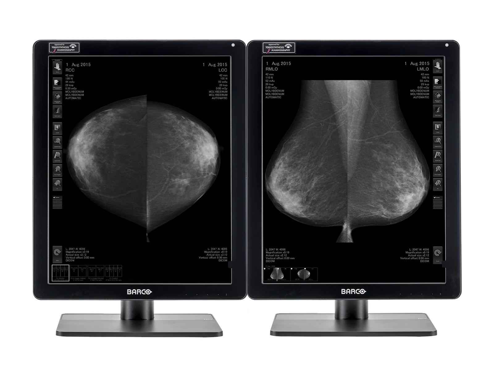 Barco Nio MDNG-6221 5MP 21" Grayscale Mammo 3D-DBT Breast Imaging Display
