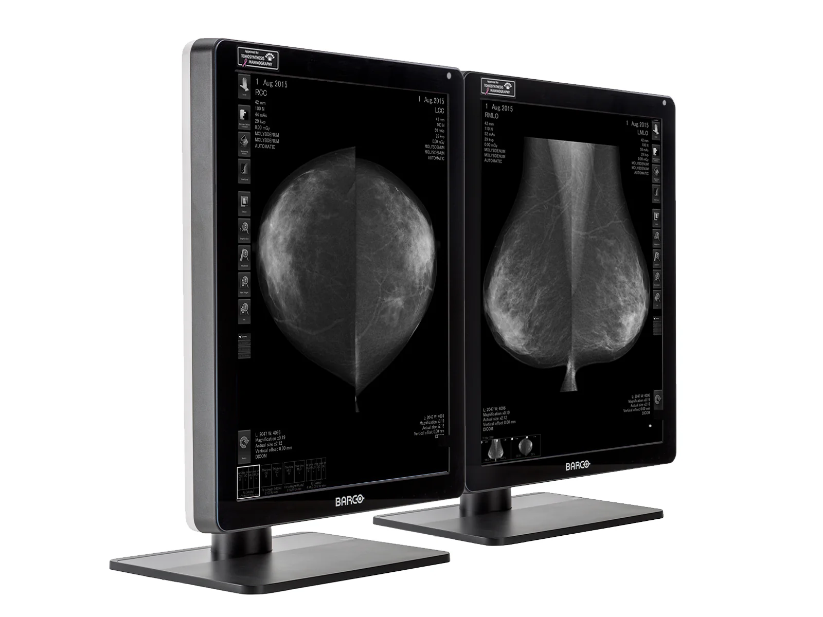 Barco Nio MDNG-6221 5MP 21" Grayscale Mammo 3D-DBT Breast Imaging Display - Image 2