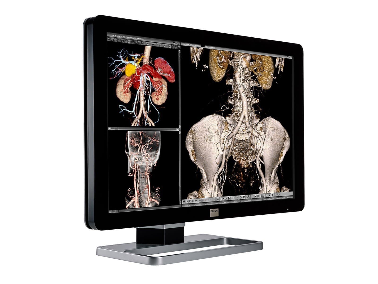 Complete PACS General Radiology Station | Barco 6MP MDCC-6230 Display | HP Workstation | Dictation Mic | Worklist Monitor (6230Z4R) - Image 3