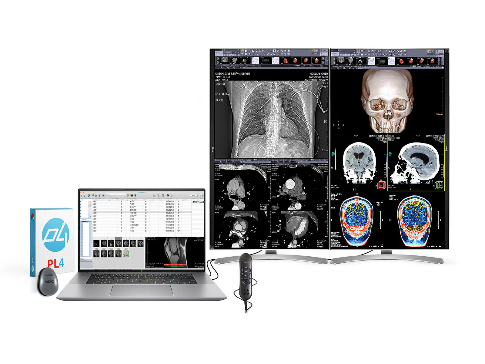 Complete Clinical Review Reading Station | 2 x LG 27M-W 27" 8MP Color Clinical Review Displays | HP ZBook Studio 16 G9 | Dictation Mic | PerfectLUM Calibration Package (LGHP16G9)